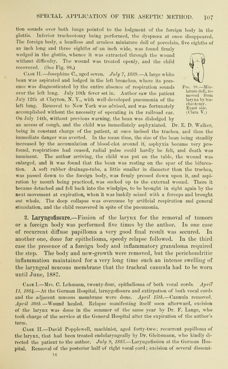 tion sounds over both lungs pointed to the lodgment of the foreign body in the glottis. Inferior tracheotomy being performed, the dyspnoea at once disappeared. The foreign body, a headless and armless miniature doll of porcelain, five eighths of an inch long and three eighths of an inch wide, was found firmly wedged in the glottis, whence it was extracted through the wound without difficulty. The wound was treated openly, and the child recovered. (See Fig. 98.) Case II.—Josephine 0., aged seven. July 7, 1SS9.—A large white bean was aspirated and lodged in the left bronchus, where its pres- ence was diagnosticated by the entire absence of respiration sounds Ftg. 98-—Min- over the left lung. July 10th fever set in. Author saw the patient moVed^froS July 12th at Clayton, N. Y., with well-developed pneumonia of the larynx by tra- left lung. Removal to New York was advised, and was fortunately ExaeTsize accomplished without the necessity of operating in the railroad ear. (Clara V.) On July 1-ttb, without previous warning, the bean was dislodged by an access of cough, and the child was immediately asphyxiated. Dr. E. D. Walker, being in constant charge of the patient, at once incised the trachea, and thus the immediate danger was averted. In the mean time, the size of the bean being steadily increased by the accumulation of blood-clot around it, asphyxia became very pro- found, respirations had ceased, radial pulse could hardly be felt, and death was imminent. The author arriving, the child was put on the table, the wound was enlarged, and it was found that the bean was resting on the spur of the bifurca- tion. A soft rubber drainage-tube, a little smaller in diameter than the trachea, was passed down to the foreign body, was firmly pressed down upon it, and aspi- ration by mouth being practiced, was sucked up to the external wound. There it became detached and fell back into the windpipe, to be brought in sight again by the next movement at expiration, when it was luckily seized with a forceps and brought out whole. The deep collapse was overcome by artificial respiration and general stimulation, and the child recovered in spite of the pneumonia. 2. Laryngofissure.—Fission of the larynx for the removal of tumors or a foreign body was performed five times by the author. In one case of recurrent diffuse papilloma a very good final result was secured. In another one, done for epithelioma, speedy relapse followed. In the third case the presence of a foreign body and inflammatory granuloma required the step. The body and new-growth were removed, but the perichondritic inflammation maintained for a very long time such an intense swelling of the laryngeal mucous membrane that the tracheal cannula had to be worn until June, 1887. Case I.—Mrs. C. Lehmann, twenty-four, epithelioma of both vocal cords. April 11, 18SJf.—At the German Hospital, larnygofissure and extirpation of both vocal cords and the adjacent mucous membrane were done. April 15th.—Cannula removed. April 30th —Wound healed. Relapse manifesting itself soon afterward, excision of the larynx was done in the summer of the same year by Dr. F. Lange, who took charge of the service at the General Hospital after the expiration of the author's term. Case II.—David Popplewell, machinist, aged forty-two; recurrent papilloma of the larynx, that had been treated endolaryngeally by Dr. Gleitsmann, who kindly di- rected the patient to the author. July 9, 1885.—Laryngofission at the German Hos- pital. Removal of the posterior half of right vocal cord; excision of several dissemi- Ifi