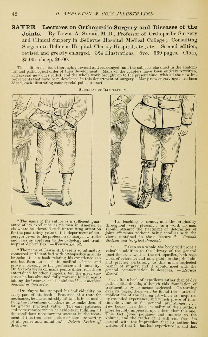 SAYRE. Lectures on Orthopaedic Surgery and Diseases of the Joints. By Lewis A. Sayke, M. D., Professor of Orthopaedic Surgery and Clinical Surgery in Bellevue Hospital Medical College ; Consulting Surgeon to Bellevue Hospital, Charity Hospital, etc., etc. Second edition, revised and greatly enlarged. 324 Illustrations. 8vo. 569 pages. Cloth, 15.00; sheep, $6.00. This edition has been thoroughly revised and rearranged, and the subjects classified in the anatom- ical and pathological order of their development. Many of the chapters have been entirely rewritten, and several new ones added, and the whole work brought up to the present time, with all the new im- provements that have been developed in this department of surgery. MaDy new engravings have been added, each illustrating some special point iu practice. Specimens of Ili pstrations.  The name of the author is a sufficient guar- antee of its excellence, as no man in America or elsewhere has devoted such unremitting attention for the past thirty years to this department of sur- gery, or given to the profession so many new truths and laws as applying to the pathology and treat- ment of deformities.—Western Lancet.  The name of Lewis A. Sayre is so intimately connected and identified with orthopedics in all its branches, that a book relating his experience can not but form an epoch in medical science, and prove a blessing to the profession and humanity. Dr. Sayre's views on many points differ from those entertained by other surgeons, but the great suc- cesses he has obtained fully warrant him in main- taining the ' courage of his opinions.' —American Journal of Obstetrics. Dr. Sayre has stamped his individuality on every part of his book. Possessed of a taste for mechanics, he has admirably utilized it in so modi- fying the inventions of others as to make them of far greater practical value. The care, patience, and perseverance which he exhibits in fulfilling all the conditions necessary for success in the treat- ment of this troublesome class of cases are worthy of all praise and imitation.—Detroit J&view of Medicine.  Tts teaching is sound, and the originality throughout very pleasing; in a word, no man Bhould attempt the treatment of deformities of joint affections without being familiar with the views contained in these lectures. — Canada Medical and Surgical Journal. ... Taken as a whole, the book will prove a valuable addition to the library of the general practitioner, as well as the orthopaedist, both as a work of reference and as a guide to the principles and practice pertaining to this much-neglected branch of surgery, and it should meet with the general commendation it deserves. — Medical Becord. . . . It is a book of expedients rather than of dry pathological details, although this foundation of treatment is by no means neglected. On turning over its pages, there will be found those practical applications of the healing art which are acquired by extended experience, and which prove of ines- timable value to the general practitioner. . . . Few books have the personality of their authors more forcibly impressed upon them than this one. This fact gives piquancy and interest to the volume, and the reader of it will rise from its perusal with the impression that its author has written of that he has had experience in, and that