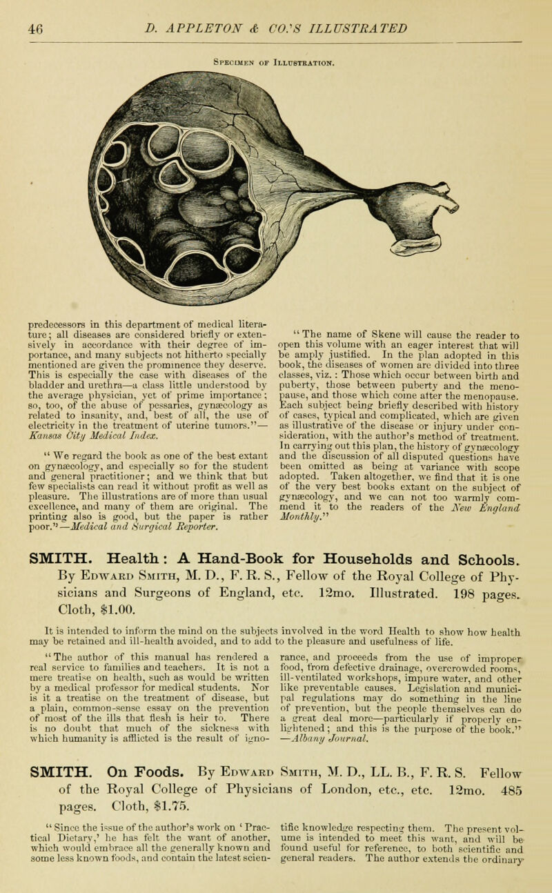 Specimen of Illustration. predecessors in this department of medical litera- ture ; all diseases are considered briefly or exten- sively in accordance with their decree of im- portance, and many subjects not hitherto specially mentioned are given the prominence they deserve. This is especially the case with diseases of the bladder and urethra—a class little understood by the average physician, yet of prime importance ; so, too, of the abuse of pessanes, gynaecology as related to insanity, and, best of all, the use of electricity in the treatment of uterine tumors.— Kansas City Medical Index.  We regard the book as one of the best extant on gynaecology, and especially so for the student and general practitioner; and we think that but few specialists can read it without protit as well as pleasure. The illustrations are of more than usual excellence, and many of them are original. The printing also is good, but the paper is rather poor.15—Medical and Surgical Reporter. The name of Skene will cause the reader to open this volume with an eager interest that will be amply justified. In the plan adopted in this book, the diseases of women are divided into three classes, viz.: Those which occur between birth and puberty, those between puberty and the meno- pause, and those which come atter the menopause. Each subject being briefly described with history of cases, typical and complicated, which are given as illustrative of the disease or injury under con- sideration, with the author's method of treatment. In carrying out this plan, the history of gynaecology and the discussion of all disputed questions have been omitted as being at variance with scope adopted. Taken altogether, we find that it is one of the very best books extant on the subject of gynaecology, and we can not too warmly com- mend it to the readers of the JS'ew i'nn' Monthly. SMITH. Health: A Hand-Book for Households and Schools. By Edward Smith, M. D., F.R. 8., Fellow of the Royal College of Phy- sicians and Surgeons of England, etc. 12mo. Illustrated. 198 pages. Cloth, $1.00. It is intended to inform the mind on the subjects involved in the word Health to show how health may be retained and ill-health avoided, and to add to the pleasure and usefulness of life.  The author of this manual has rendered a real service to families and teachers. It is not a mere treatise on health, such as would be written by a medical professor for medical students. Nor is it a treatise on the treatment of disease, but a plain, commoD-sense essay on the prevention of most of the ills that flesh is heir to. There a great deal more—particularly if properly en is no doubt that much of the sickness with lightened; and this is the purpose ot the book.' which humanity is afflicted is the result of igno- —Albany Journal. ranee, and proceeds from the use of improper food, from defective drainage, overcrowded rooms, ill-ventilated workshops, impure water, and other like preventable causes. Legislation and munici- pal regulations may do something in the line of prevention, but the people themselves can do SMITH. On Foods. By Edward Smith, M. D., LL. B., F. R. S. Fellow of the Royal College of Physicians of London, etc., etc. 12mo. 485 pages. Cloth, $1.75.  Since the issue of the author's work on ' Prac- tical Dietary,' he has felt the want of another, which would embrace all the generally known and some less known foods, and contain the latest scien- tific knowledge respecting them. The present vol- ume is intended to meet this want, and will be found useful for reference, to both scientific and general readers. The author extends the ordinary