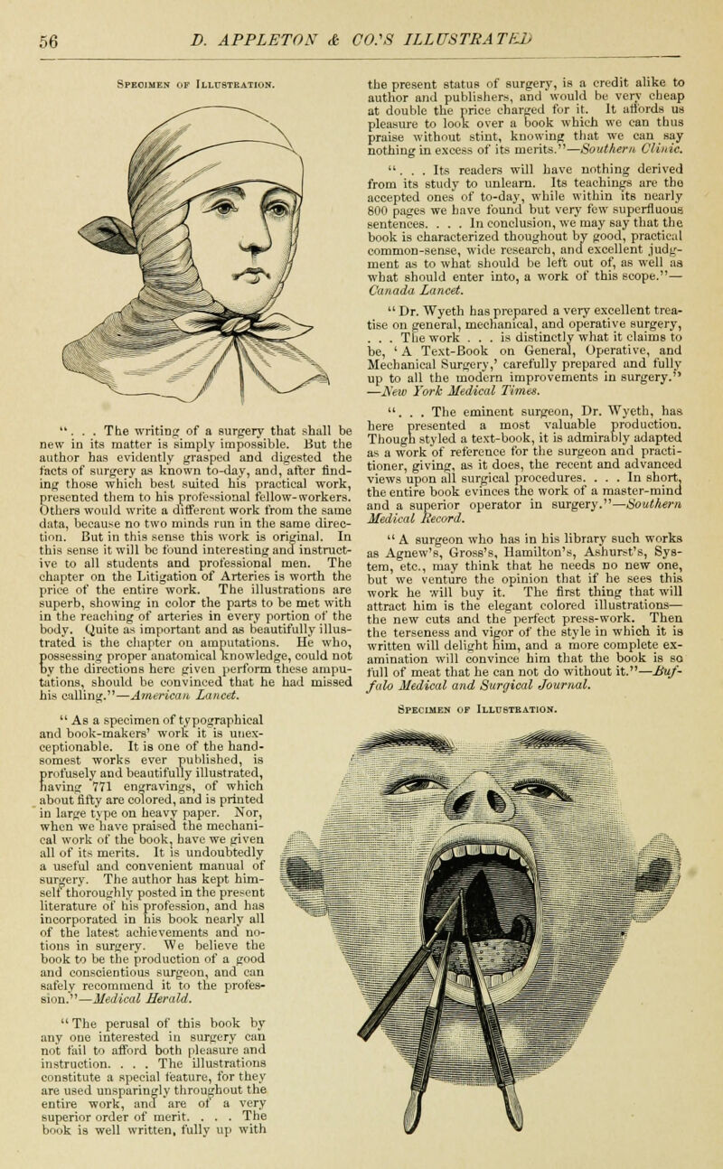 Specimen of Illustration. ... The writing of a surgery that shall be new in its matter is simply impossible. But the author has evidently grasped and digested the facts of surgery as known to-day, and, after find- ing those whicli best suited his practical work, presented them to his professional fellow-workers. Others would write a different work from the same data, because no two minds run in the same direc- tion. But in this sense this work is original. In this sense it will be found interesting and instruct- ive to all students and professional men. The chapter on the Litigation of Arteries is worth the price of the entire work. The illustrations are superb, showing in color the parts to be met with in the reaching of arteries in every portion of the body. Quite as important and as beautifully illus- trated is the chapter on amputations. He who, possessing proper anatomical Knowledge, could not by the directions here given perform these ampu- tations, should be convinced that he had missed his calling.—American Lancet.  As a specimen of typographical and book-makers' work it is unex- ceptionable. It is one of the hand- somest works ever published, is Erofusely and beautifully illustrated, aving 771 engravings, of which about fifty are colored, and is printed in large type on heavy paper. Nor, when we have praised the mechani- cal work of the book, have we given all of its merits. It is undoubtedly a useful and convenient manual of surgery. The author has kept him- self thoroughly posted in the present literature of his profession, and has incorporated in his book nearly all of the latest achievements and no- tions in surgery. We believe the book to be the production of a good and conscientious surgeon, and can safely recommend it to the profes- sion.—Medical Herald.  The perusal of this book by any one interested in surgery can not fail to afford both pleasure and instruction. . . . The illustrations constitute a special feature, for they are used unsparingly throughout the entire work, and are ot a very superior order of merit. . . . The book is well written, fully up with the present status of surgery, is a credit alike to author and publishers, and would be very cheap at double the price charged for it. It affords us pleasure to look over a book which we can thus praise without stint, knowing that we can say nothing in excess of its merits.—Southern Clinic. ... Its readers will have nothing derived from its study to unlearn. Its teachings are the accepted ones of to-day, while within its nearly 800 pages we have found but very few superfluous sentences. ... In conclusion, we may say that the book is characterized thoughout by good, practical common-sense, wide research, and excellent judg- ment as to what should be left out of, as well as what should enter into, a work of this scope.— Canada Lancet.  Dr. Wyeth has prepared a very excellent trea- tise on general, mechanical, and operative surgery, . . . The work ... is distinctly what it claims to be, ' A Text-Book on General, Operative, and Mechanical Surgery,' carefully prepared and fully up to all the modern improvements in surgery. —Hew York Medical Times. ... The eminent surgeon, Dr. Wyeth, has here presented a most valuable production. Though styled a text-book, it is admirably adapted as a work of reference for the surgeon and practi- tioner, giving, as it does, the recent and advanced views upon all surgical procedures. ... In short, the entire book evinces the work of a master-mind and a superior operator in surgery.—Southern Medical Record.  A surgeon who has in his library such works as Agnew's, Gross's, Hamilton's, Ashurst's, Sys- tem, etc., may think that he needs no new one, but we venture the opinion that if he sees this work he will buy it. The first thing that will attract him is the elegant colored illustrations— the new cuts and the perfect press-work. Then the terseness and vigor of the style in which it is written will delight him, and a more complete ex- amination will convince him that the book is so full of meat that he can not do without it.—Buf- falo Medical and Surgical Journal. Specimen of Illustration.