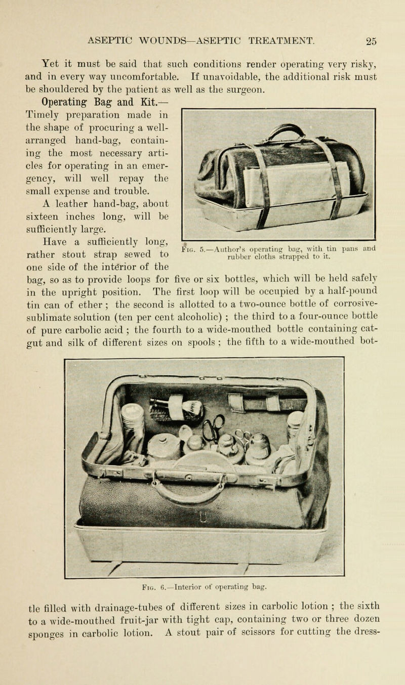 Yet it must be said that such conditions render operating very risky, and in every way uncomfortable. If unavoidable, the additional risk must be shouldered by the patient as well as the surgeon. Operating Bag and Kit- Timely preparation made in the shape of procuring a well- arranged hand-bag, contain- ing the most necessary arti- cles for operating in an emer- gency, will well repay the small expense and trouble. A leather hand-bag, about sixteen inches long, will be sufficiently large. Have a sufficiently long, rather stout strap sewed to one side of the interior of the bag, so as to provide loops for five or six bottles, which will be held safely in the upright position. The first loop will be occupied by a half-pound tin can of ether ; the second is allotted to a two-ounce bottle of corrosive- sublimate solution (ten per cent alcoholic) ; the third to a four-ounce bottle of pure carbolic acid ; the fourth to a wide-mouthed bottle containing cat- gut and silk of different sizes on spools ; the fifth to a wide-mouthed bot- Fig. 5.- •Author's operating bag, with tin pans and rubber cloths strapped to it. Interior of operating bag. tie filled with drainage-tubes of different sizes in carbolic lotion ; the sixth to a wide-mouthed fruit-jar with tight cap, containing two or three dozen sponges in carbolic lotion. A stout pair of scissors for cutting the dress-