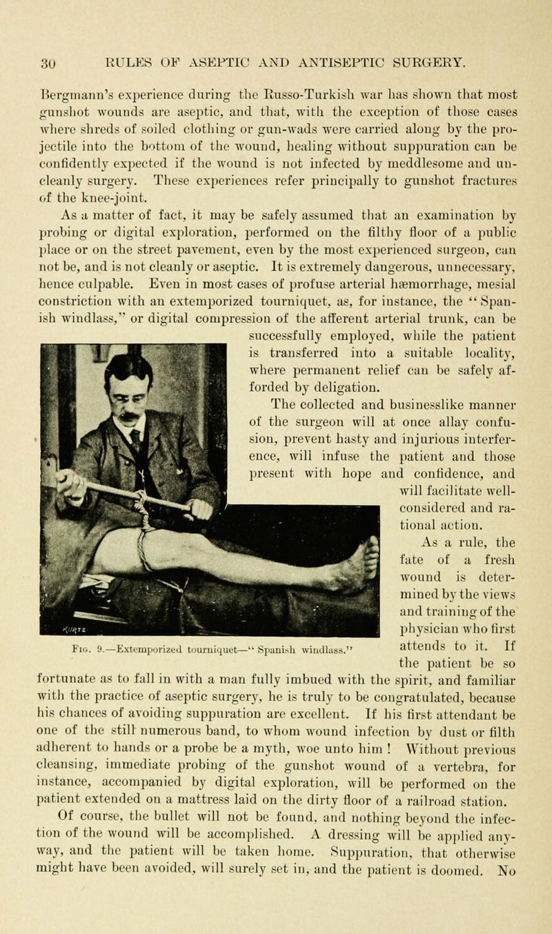 Bergmann's experience during the Itusso-Turkish war has shown that most gunshot wounds are aseptic, and that, with the exception of those cases where shreds of soiled clothing or gun-wads were carried along by the pro- jectile into the bottom of the wound, healing without suppuration can be confidently expected if the wound is not infected by meddlesome and un- cleanly surgery. These experiences refer principally to gunshot fractures of the knee-joint. As a matter of fact, it may be safely assumed that an examination by probing or digital exploration, performed on the filthy floor of a public place or on the street pavement, even by the most experienced surgeon, can not be, and is not cleanly or aseptic. It is extremely dangerous, unnecessary, hence culpable. Even in most cases of profuse arterial haemorrhage, mesial constriction with an extemporized tom-niquet, as, for instance, the Span- ish windlass, or digital compression of the afferent arterial trunk, can be successfully employed, while the patient is transferred into a suitable locality, where permanent relief can be safely af- forded by deligation. The collected and businesslike manner of the surgeon will at once allay confu- sion, prevent hasty and injurious interfer- ence, will infuse the patient and those present with hope and confidence, and will facilitate well- considered and ra- tional action. As a rule, the fate of a fresh wound is deter- mined by the views and training of the physician who first attends to it. If the patient be so fortunate as to fall in with a man fully imbued with the spirit, and familiar with the practice of aseptic surgery, he is truly to be congratulated, because his chances of avoiding suppuration are excellent. If his first attendant be one of the still numerous band, to whom wound infection by dust or filth adherent to hands or a probe be a myth, woe unto him ! Without previous cleansing, immediate probing of the gunshot wound of a vertebra, for instance, accompanied by digital exploration, will be performed on the patient extended on a mattress laid on the dirty floor of a railroad station. Of course, the bullet will not be found, and nothing beyond the infec- tion of the wound will be accomplished. A dressing will be applied any- way, and the patient will be taken home. Suppuration, that otherwise might have been avoided, will surely set in, and the patient is doomed. No Fig. 9.—Extemporized tourniquet— Spanish windlass.