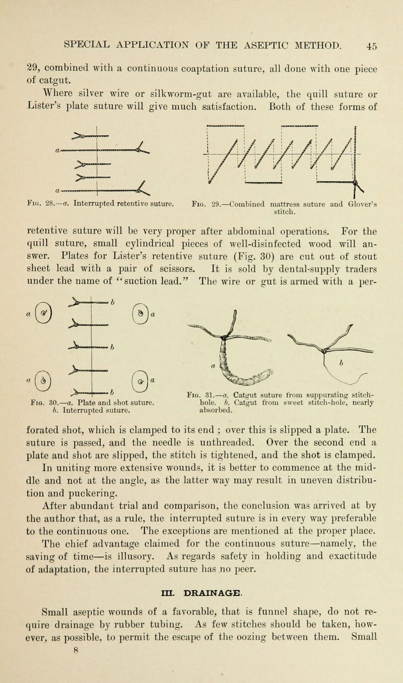 29, combined with a continuous coaptation suture, all done with one piece of catgut. Where silver wire or silkworm-gut are available, the quill suture or Lister's plate suture will give much satisfaction. Both of these forms of Fig. 28.—a. Interrupted retentive suture. Fio 29.—Combined mattress suture and Glover's stitch. retentive suture will be very proper after abdominal operations. For the quill suture, small cylindrical pieces of well-disinfected wood will an- swer. Plates for Lister's retentive suture (Fig. 30) are cut out of stout sheet lead with a pair of scissors. It is sold by dental-supply traders under the name of suction lead. The wire or gut is armed with a per- > Fig. Q- \a 30.—a. Plate and shot suture. b. Interrupted suture. Fig. 31.—a. Catgut suture from suppurating stitch- hole, b. Catgut from sweet stitch-hole, nearly absorbed. forated shot, which is clamped to its end ; over this is slipped a plate. The suture is passed, and the needle is unthreaded. Over the second end a plate and shot are slipped, the stitch is tightened, and the shot is clamped. In uniting more extensive wounds, it is better to commence at the mid- dle and not at the angle, as the latter way may result in uneven distribu- tion and puckering. After abundant trial and comparison, the conclusion was arrived at by the author that, as a rule, the interrupted suture is in every way preferable to the continuous one. The exceptions are mentioned at the proper place. The chief advantage claimed for the continuous suture—namely, the saving of time—is illusory. As regards safety in holding and exactitude of adaptation, the interrupted suture has no peer. in. DRAINAGE. Small aseptic wounds of a favorable, that is funnel shape, do not re- quire drainage by rubber tubing. As few stitches should be taken, how- ever, as possible, to permit the escape of the oozing between them. Small 8
