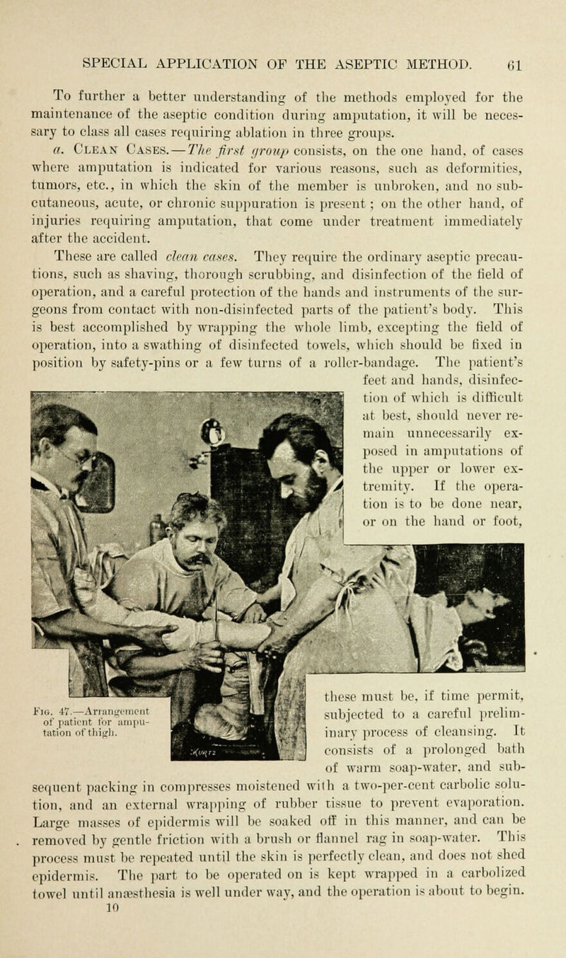 To further a better understanding of the methods employed for the maintenance of the aseptic condition during amputation, it will be neces- sary to class all cases requiring ablation in three groups. a. Clean Cases. — The first group consists, on the one hand, of cases where amputation is indicated for various reasons, such as deformities, tumors, etc., in which the skin of the member is unbroken, and no sub- cutaneous, acute, or chronic suppuration is present; on the other hand, of injuries requiring amputation, that come under treatment immediately- after the accident. These are called clean cases. They require the ordinary aseptic precau- tions, such as shaving, thorough scrubbing, and disinfection of the field of operation, and a careful protection of the hands and instruments of the sur- geons from contact with non-disinfected parts of the patient's body. This is best accomplished by wrapping the whole limb, excepting the field of operation, into a swathing of disinfected towels, which should be fixed in position by safety-pins or a few turns of a roller-bandage. The patient's feet and hands, disinfec- tion of which is difficult at best, should never re- main unnecessarily ex- posed in amputations of the upper or lower ex- tremity. If the opera- tion is to be done near, or on the hand or foot, these must be, if time permit, Fig. 47— Arrmi^N.eut -V ^iJLH subjected to a careful prelim- ot patient tor ainpu- yU H tation of thigh. ^^^/^HBi'-il inary process of cleansing. It consists of a prolonged bath of warm soap-water, and sub- sequent packing in compresses moistened with a two-per-cent carbolic solu- tion, and an external wrapping of rubber tissue to prevent evaporation. Large masses of epidermis will be soaked off in this manner, and can be removed by gentle friction with a brush or flannel rag in soap-water. This process must be repeated until the skin is perfectly clean, and does not shed epidermis. The part to be operated on is kept wrapped in a carbolized towel until anaesthesia is well under way, and the operation is about to begin. 10