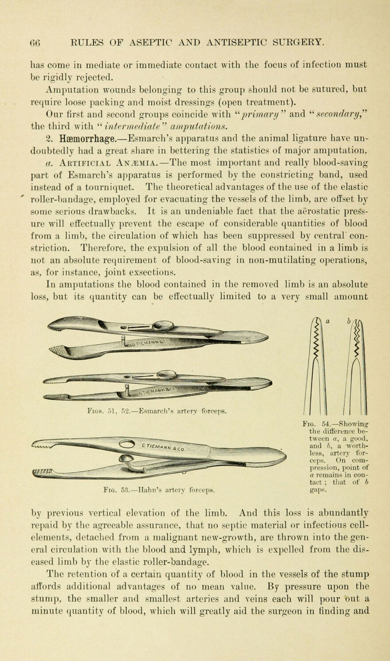 has come in mediate or immediate contact with the focus of infection must be rigidly rejected. Amputation wounds belonging to this group should not be sutured, but require loose packing and moist dressings (open treatment). Our first and second groups coincide with primary and secondary,' the third with  intermediate  amputations. 2. Haemorrhage.—Esmarch's apparatus and the animal ligature have un- doubtedly had a great share in bettering the statistics of major amputation. a. Artificial Anemia.—The most important and really blood-saving part of Esmarch's apparatus is performed by the constricting band, used instead of a tourniquet. The theoretical advantages of the use of the elastic roller-bandage, employed for evacuating the vessels of the limb, are offset by some serious drawbacks. It is an undeniable fact that the aerostatic press- ure will effectually prevent the escape of considerable quantities of blood from a limb, the circulation of which has been suppressed by central con- striction. Therefore, the expulsion of all the blood contained in a limb is not an absolute requirement of blood-saving in non-mutilating operations, as, for instance, joint exsections. In amputations the blood contained in the removed limb is an absolute loss, but its quantity can be effectually limited to a very small amount Figs. 51, 52.—Esmarch's artery forceps. Fig. 53.—llahn's artery forceps. Fig. 54.—Showing the difference be- tween '/, a good. and li, a worth- less, artery fi >r- ceps. t'n com- pression, point of a remains in con- tact ; that of b gaps. by previous vertical elevation of the limb. And this loss is abundantly repaid by the agreeable assurance, that no septic material or infectious cell- elements, detached from a malignant new-growth, are thrown into the gen- eral circulation with the blood and lymph, which is expelled from the dis- eased limb by the elastic roller-bandage. The retention of a certain quantity of blood in the vessels of the stump affords additional advantages of no mean value. By pressure upon the stump, the smaller and smallest arteries and veins each will pour out a minute quantity of blood, which will greatly aid the surgeon in finding and