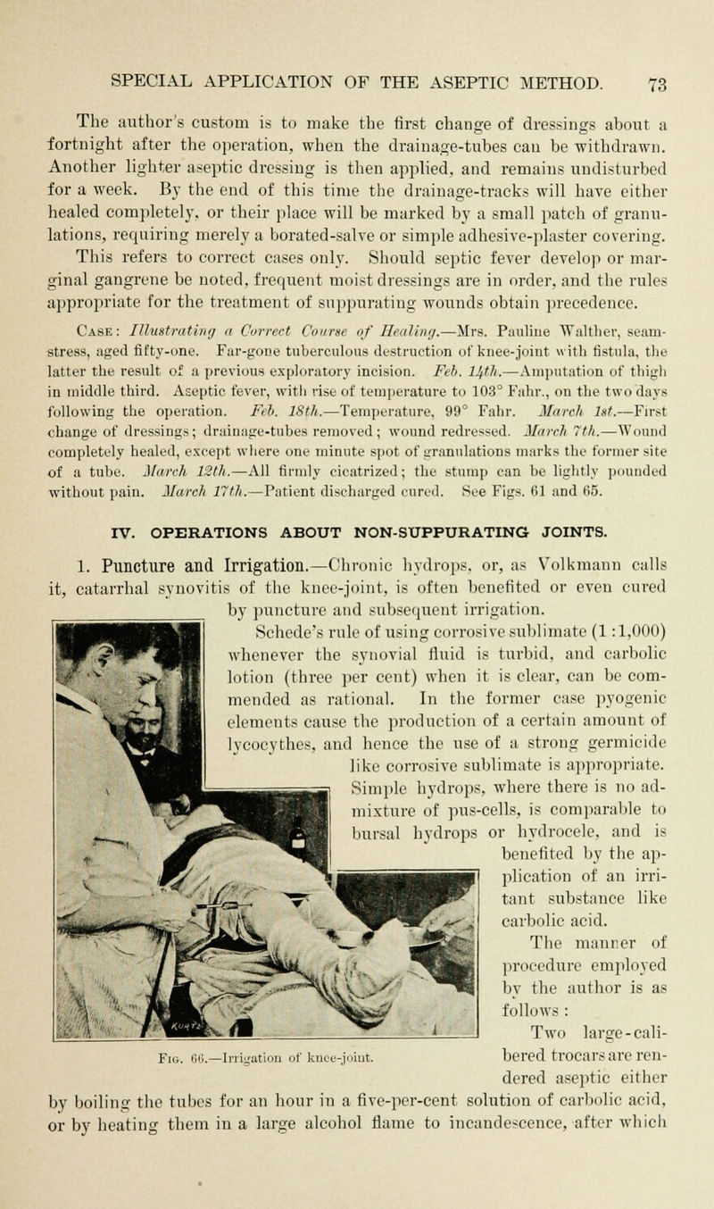 The author's custom is to make the first change of dressings about a fortnight after the operation, when the drainage-tubes can be withdrawn. Another lighter aseptic dressing is then applied, and remains undisturbed for a week. By the end of this time the drainage-tracks will have either healed completely, or their place will be marked by a small patch of granu- lations, requiring merely a bora ted-salve or simple adhesive-plaster covering. This refers to correct cases only. Should septic fever develop or mar- ginal gangrene be noted, frequent moist dressings are in order, and the rules appropriate for the treatment of suppurating wounds obtain precedence. Case : Illustrating a Correct Course of Healing.—Mrs. Pauline Walther, seam- stress, aged fifty-one. Far-gone tuberculous destruction of knee-joint with fistula, the latter the result of a previous exploratory incision. Feb. Hth.—Amputation of thigh in middle third. Aseptic fever, with rise of temperature to 103° Fahr., on the two days following the operation. Feb. 18th.—Temperature, 99° Fahr. March 1st.—First change of dressings; drainage-tubes removed; wound redressed. March 7th.—Wound completely healed, except where one minute spot of granulations marks the former site of a tube. March 12th.—All firmly cicatrized; the stump can be lightly pounded without pain. March 17th.—Patient discharged cured. See Figs. 61 and 65. IV. OPERATIONS ABOUT NON-SUPPURATING JOINTS. 1. Puncture and Irrigation.—Chronic hydrops, or, as Volkmann calls it, catarrhal synovitis of the knee-joint, is often benefited or even cured by puncture and subsequent irrigation. Schede's rule of using corrosive sublimate (1:1,000) whenever the synovial fluid is turbid, and carbolic lotion (three per cent) when it is clear, can be com- mended as rational. In the former case pyogenic elements cause the production of a certain amount of lycocytb.es, and hence the use of a strong germicide like corrosive sublimate is appropriate. Simple hydrops, where there is no ad- mixture of pus-cells, is comparable to bursal hydrops or hydrocele, and is benefited by the ap- plication of an irri- tant substance like carbolic acid. The manner of procedure employed by the author is as follows : Two large - cali- bered trocars are ren- dered aseptic either by boiling the tubes for an hour in a five-per-cent solution of carbolic acid, or by heating them in a large alcohol flame to incandescence, after which 6ii.—Irrigation of knee-joint.