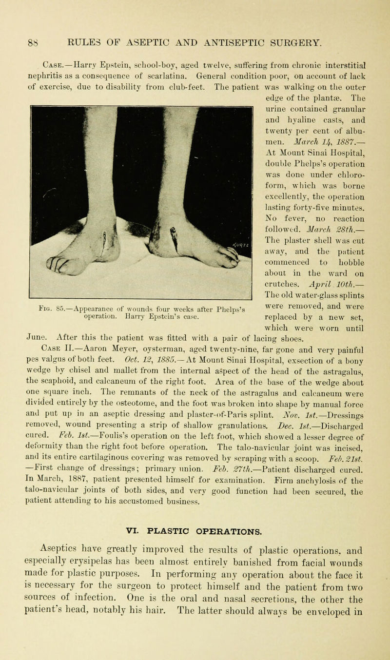 Case.—Harry Epstein, school-boy, aged twelve, suffering from chronic interstitial nephritis as a consequence of scarlatina. General condition poor, on account of lack of exercise, due to disability from club-feet. The patient was walking on the outer edge of the plant*. The urine contained granular and hyaline casts, and twenty per cent of albu- men. March U, 1887.— At Mount Sinai Hospital, double Phelps's operation was done under chloro- form, which was borne excellently, the operation lasting forty-five minutes. No fever, no reaction followed. March 28th.— The plaster shell was cut away, and the patient commenced to hobble about in the ward on crutches. April 10th.— The old water-glass splints were removed, and were replaced by a new set, which were worn until June. After this the patient was fitted with a pair of lacing shoes. Case II.—Aaron Meyer, oysterman, aged twenty-nine, far gone and very painful pes valgus of both feet. Oct. 12, 1885.— At Mount Sinai Hospital, exsection of a bony wedge by chisel and mallet from the internal aspect of the head of the astragalus, the scaphoid, and calcaneum of the right foot. Area of the base of the wedge about one square inch. The remnants of the neck of the astragalus and calcaneum were divided entirely by the osteotome, and the foot was broken into shape by manual force and put up in an aseptic dressing and plaster-of-Paris splint. Nov. 1st.— Dressings removed, wound presenting a strip of shallow granulations. Dec. 1st.—Discharged cured. Feb. 1st.—Foulis's operation on the left foot, which showed a lesser degree of deformity than the right foot before operation. The talo-navicular joint was incised, and its entire cartilaginous covering was removed by scraping with a scoop. Feb. 21st. —First change of dressings; primary union. Feb. 27th—Patient discharged cured. In March, 1887, patient presented himself for examination. Firm anchylosis of the talo-navicular joints of both sides, and very good function had been secured, the patient attending to his accustomed business. Fig. 85.—Appearance of wounds four weeks after Phelps's operation. Harry Epstein's case. VI. PLASTIC OPERATIONS. Aseptics have greatly improved the results of plastic operations, and especially erysipelas has been almost entirely banished from facial wounds made for plastic purposes. In performing any operation about the face it is necessary for the surgeon to protect himself and the patient from two sources of infection. One is the oral and nasal secretions, the other the patient's head, notably his hair. The latter should always be enveloped in