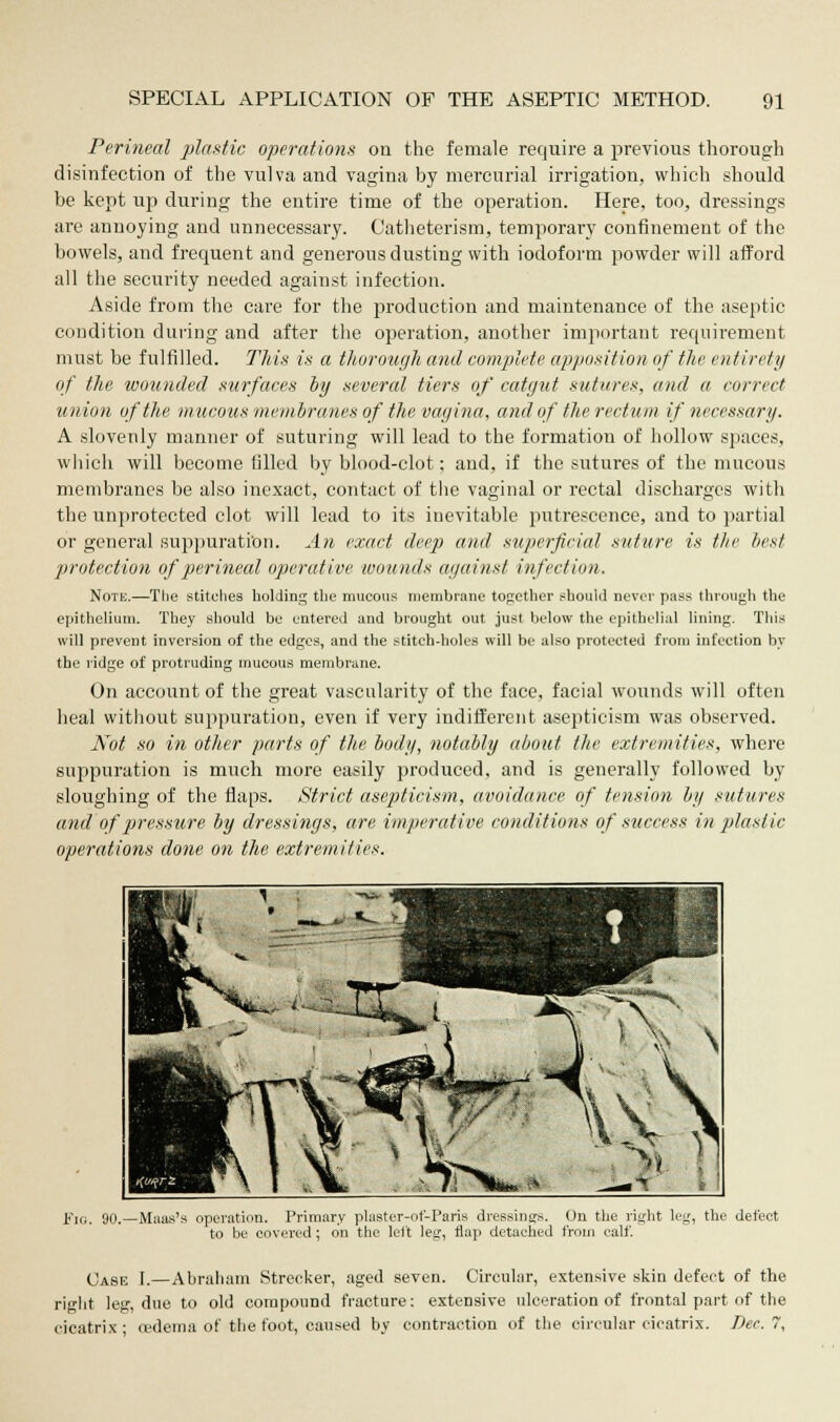 Perineal plastic operations on the female require a previous thorough disinfection of the vulva and vagina by mercurial irrigation, which should be kept up during the entire time of the operation. Here, too, dressings are annoying and unnecessary. Catheterism, temporary confinement of the bowels, and frequent and generous dusting with iodoform powder will afford all the security needed against infection. Aside from the care for the production and maintenance of the aseptic condition during and after the operation, another important requirement must be fulfilled. This is a thorough and complete apposition of the entirety of the wounded surfaces by several tiers of catgut sutures, and a correct union of the mucous membranes of the vagina, and of the rectum if necessary. A slovenly manner of suturing will lead to the formation of hollow spaces, which will become filled by blood-clot; and, if the sutures of the mucous membranes be also inexact, contact of the vaginal or rectal discharges with the unprotected clot will lead to its inevitable putrescence, and to partial or general suppuration. An exact deep and superficial suture is the best protection of perineal operative wounds against infection. Note.—The stitches holding the mucous membrane together should never pass through the epithelium. They should be entered and brought out just below the epithelial lining. This will prevent inversion of the edges, and the stitch-holes will be also protected from infection by the ridge of protruding mucous membrane. On account of the great vascularity of the face, facial wounds will often heal without suppuration, even if very indifferent asepticism was observed. Not so in other parts of the body, notably about the extremities, where suppuration is much more easily produced, and is generally followed by sloughing of the flaps. Strict asepticism, avoidance of tension by sutures and of pressure by dressings, are imperative conditions of success in plastic operations done on the extremities. Fig. 90.—Maas's operation. Primary plaster-ot'-Paris dressings. On the right leg, the defect to be covered; on the left leg, flap detached from calf. Case I.—Abraham Strecker, aged seven. Circular, extensive skin defect of the right leg, due to old compound fracture: extensive ulceration of frontal part of the cicatrix; cedema of the foot, caused by contraction of the circular cicatrix. Dec. 7,