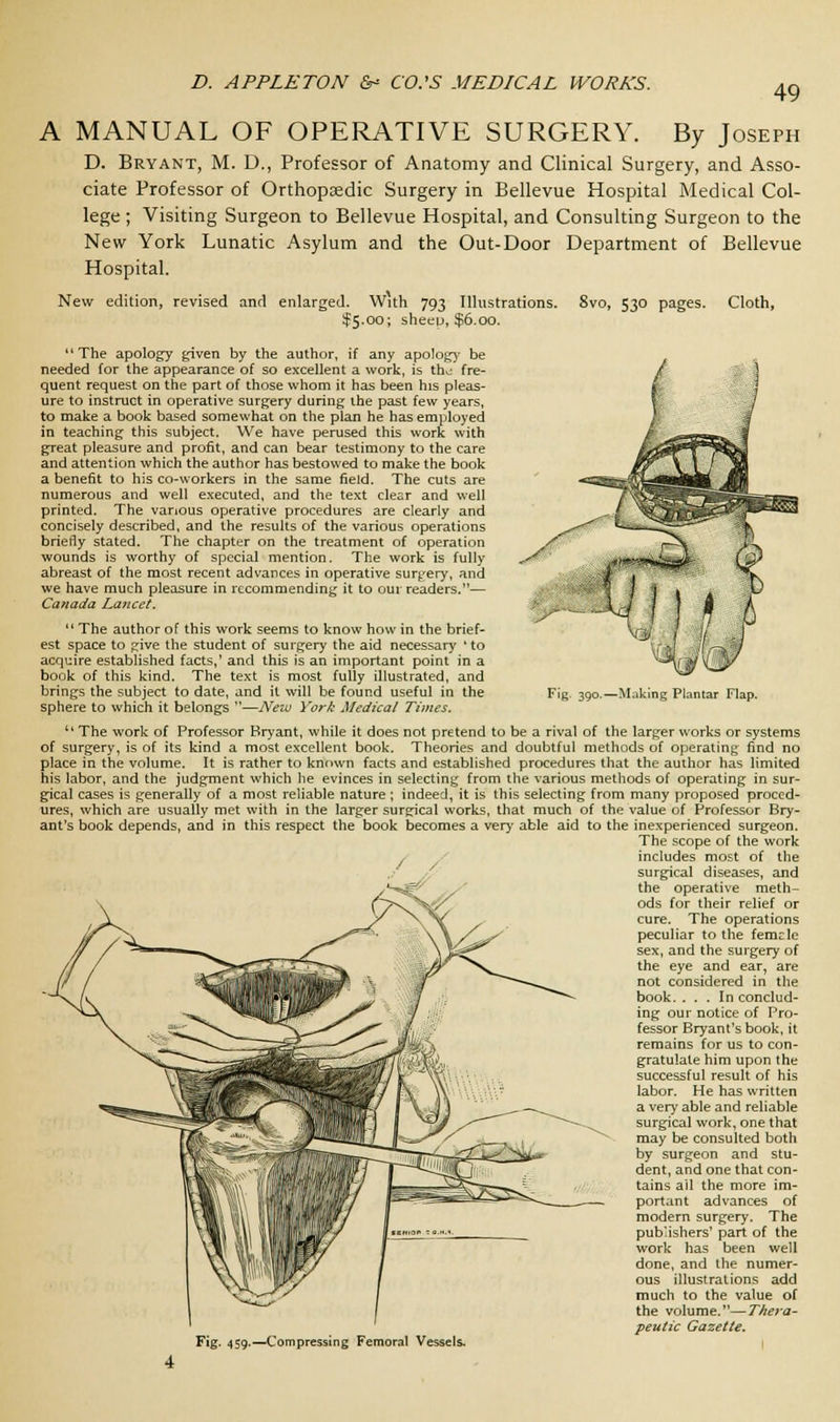 49 fig 390-—Making Plantar Flap. A MANUAL OF OPERATIVE SURGERY. By Joseph D. Bryant, M. D., Professor of Anatomy and Clinical Surgery, and Asso- ciate Professor of Orthopaedic Surgery in Bellevue Hospital Medical Col- lege ; Visiting Surgeon to Bellevue Hospital, and Consulting Surgeon to the New York Lunatic Asylum and the Out-Door Department of Bellevue Hospital. New edition, revised and enlarged. With 793 Illustrations. 8vo, 530 pages. Cloth, $5.00; sheeu, $6.00. The apology given by the author, if any apology be needed for the appearance of so excellent a work, is th^ fre- quent request on the part of those whom it has been his pleas- ure to instruct in operative surgery during ihe past few years, to make a book based somewhat on the plan he has employed in teaching this subject. We have perused this work with great pleasure and profit, and can bear testimony to the care and attention which the author has bestowed to make the book a benefit to his co-workers in the same field. The cuts are numerous and well executed, and the text clear and well printed. The various operative procedures are clearly and concisely described, and the results of the various operations briefly stated. The chapter on the treatment of operation wounds is worthy of special mention. The work is fully abreast of the most recent advances in operative surgery, and we have much pleasure in recommending it to our readers.— Canada Lancet.  The author of this work seems to know how in the brief- est space to give the student of surgery the aid necessary 'to acquire established facts,' and this is an important point in a book of this kind. The text is most fully illustrated, and brings the subject to date, and it will be found useful in the sphere to which it belongs —New York Medical Times. The work of Professor Bryant, while it does not pretend to be a rival of the larger works or systems of surgery, is of its kind a most excellent book. Theories and doubtful methods of operating find no place in the volume. It is rather to known facts and established procedures that the author has limited his labor, and the judgment which he evinces in selecting from the various methods of operating in sur- gical cases is generally of a most reliable nature ; indeed, it is this selecting from many proposed proced- ures, which are usually met with in the larger surgical works, that much of the value of Professor Bry- ant's book depends, and in this respect the book becomes a very able aid to the inexperienced surgeon. The scope of the work includes most of the surgical diseases, and the operative meth- ods for their relief or cure. The operations peculiar to the femcle sex, and the surgery of the eye and ear, are not considered in the book. ... In conclud- ing our notice of Pro- fessor Bryant's book, it remains for us to con- gratulate him upon the successful result of his labor. He has written a very able and reliable surgical work, one that may be consulted both by surgeon and stu- dent, and one that con- tains all the more im- portan t ad vances of modern surgery. The publishers' part of the work has been well done, and the numer- ous illustrations add much to the value of the volume.—Thera- peutic Gazette. Fig. 459.—Compressing Femoral Vessels.