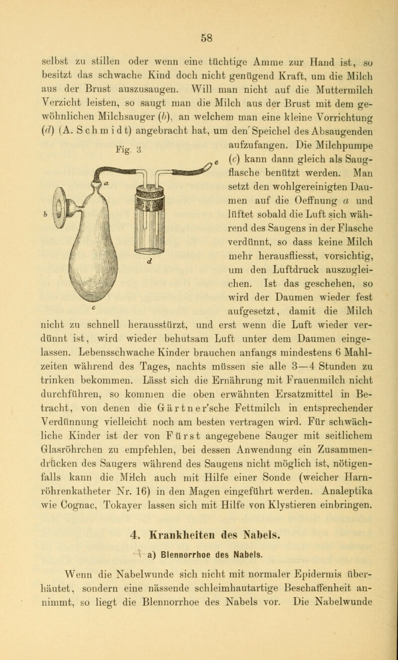 selbst zu stillen oder wenn eine tüchtige Amme zur Hand ist, so besitzt das schwache Kind doch nicht genügend Kraft, um die Milch aus der Brust auszusaugen. Will man nicht auf die Muttermilch Verzicht leisten, so saugt man die Milch aus der Brust mit dem ge- wöhnlichen Milchsauger (/>), an welchem man eine kleine Vorrichtung (d) (A. Schmidt) angebracht hat, um denr Speichel des Absaugenden Fig. 3. aufzufangen. Die Milchpumpe (c) kann dann gleich als Saug- flasche benützt werden. Man setzt den wohlgereinigten Dau- men auf die Oeffnung a und lüftet sobald die Luft sich wäh- rend des Saugens in der Flasche verdünnt, so dass keine Milch mehr herausfliesst, vorsichtig, um den Luftdruck auszuglei- chen. Ist das geschehen, so wird der Daumen wieder fest aufgesetzt, damit die Milch nicht zu schnell herausstürzt, und erst wenn die Luft wieder ver- dünnt ist, wird wieder behutsam Luft unter dem Daumen einge- lassen. Lebensschwache Kinder brauchen anfangs mindestens 6 Mahl- zeiten während des Tages, nachts müssen sie alle 3—4 Stunden zu trinken bekommen. Lässt sich die Ernährung mit Frauenmilch nicht durchführen, so kommen die oben erwähnten Ersatzmittel in Be- tracht, von denen die Gärtner'sche Fettmilch in entsprechender Verdünnung vielleicht noch am besten vertragen wird. Für schwäch- liche Kinder ist der von Fürst angegebene Sauger mit seitlichem Glasröhrchen zu empfehlen, bei dessen Anwendung ein Zusammen- drücken des Saugers während des Saugens nicht möglich ist, nötigen- falls kann die Mi-Ich auch mit Hilfe einer Sonde (weicher Harn- röhrenkatheter Nr. 16) in den Magen eingeführt werden. Analeptika wie Cognac, Tokayer lassen sich mit Hilfe von Klystieren einbringen. 4. Krankheiten des Nabels. a) Blennorrhoe des Nabels. Wenn die Nabelwunde sich nicht mit normaler Epidermis über- häutet, sondern eine nässende schleimhautartige Beschaffenheit an- nimmt, so liegt die Blennorrhoe des Nabels vor. Die Nabelwunde