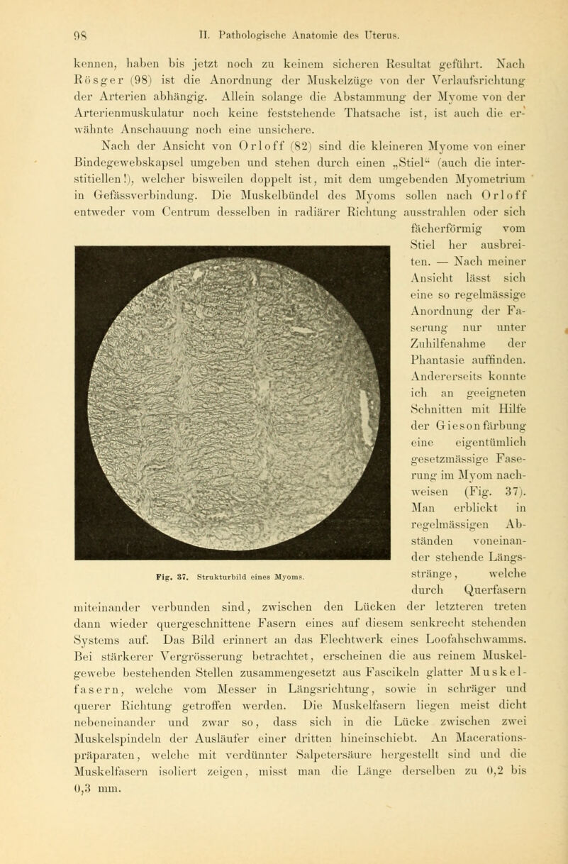 kennen, haben bis jetzt noch zu keinem sicheren Resultat geführt. Nach Rösger (98) ist die Anordnung der Muskelzüge von der Verlaufsrichtung der Arterien abhängig. Allein solange die Abstammung der Myome von der Arterienmuskulatur noch keine feststehende Tliatsaehe ist, ist auch die er- wähnte Anschauung noch eine unsichere. Nach der Ansicht von Orloff (82) sind die kleineren Myome von einer Bindegewebskapsel umgeben und stehen durch einen „Stiel (auch die inter- stitiellen!), welcher bisweilen doppelt ist, mit dem umgebenden Myometrium in Gefässverbindung. Die Muskelbündel des Myoms sollen nach Orloff entweder vom Centrum desselben in radiärer Richtung ausstrahlen oder sich fächerförmig vom Stiel her ausbrei- ten. — Nach meiner Ansicht lässt sich eine so regelmässige Anordnung der Fa- serung nur unter Zuhilfenahme der Phantasie auffinden. Andererseits konnte ich an geeigneten Schnitten mit Hilfe der eine gesetzmässige Fase- rung im Myom nach- weisen (Fig. 37). Man erblickt in regelmässigen Ab- Griesonfärbung eigentümlich Fig. 37. Strukturbild eines Myoms. ständen voneinan- der stellende Längs- weiche stränge, durch Querfasern miteinander verbunden sind, zwischen den Lücken der letzteren treten dann wieder quergeschnittene Fasern eines auf diesem senkrecht stehenden Systems auf. Das Bild erinnert an das Flechtwerk eines Loofahschwamms. Bei stärkerer Vergrösserung betrachtet, erscheinen die aus reinem Muskel- gewebe bestehenden Stellen zusammengesetzt aus Fascikeln glatter Muskel- fasern, welche vom Messer in Längsrichtung, sowie in schräger und querer Richtung getroffen werden. Die Muskelfasern liegen meist dicht nebeneinander und zwar so, dass sich in die Lücke zwischen zwei Muskelspindeln der Ausläufer einer dritten hineinschiebt. An Macerations- präparaten, welche mit verdünnter Salpetersäure hergestellt sind und die Muskelfasern isoliert zeigen, misst man die Länge derselben zu 0,'2 bis 0,3 mm.