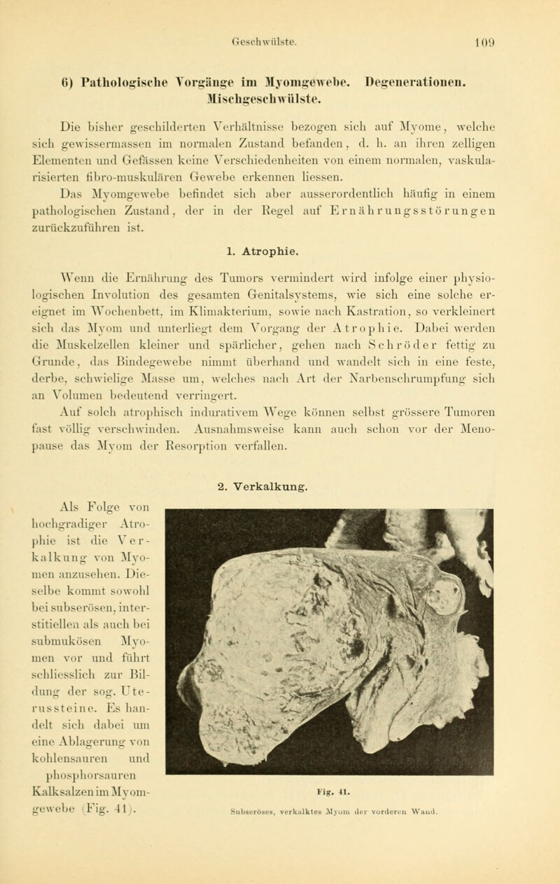 6) Pathologische Vorgänge im MyomgeVebe. Degenerationen. Mlschgeschwülste. Die bisher geschilderten Verhältnisse bezogen sieh auf Myome, welche sich gewissennassen im normalen Zustand befanden . d. h. an ihren zelligen Elementen und Gefässen keine Verschiedenheiten von einem normalen, vaskula- risierten fibro-muskulären Gewebe erkennen liessen. Das Myomgewebe befindet sieh aber ausserordentlich häutig in einem pathologischen Zustand, der in der Regel auf Ernährungsstörungen zunickzuführen ist. 1. Atrophie. Wenn die Ernährung des Tumors vermindert wird infolge einer physio- logischen Involution des gesamten Genitalsystems, wie sich eine solche er- eignet im Wochenbett, im Klimakterium, sowie nach Kastration, so verkleinert sieh das Myom und unterliegt dem Vorgang der Atrophie. Dabei werden die Muskelzellen kleiner und spärlicher, gehen nach Schröder fettig zu Grunde, das Bindegewebe nimmt überhand und wandelt sich in eine feste, derbe, schwielige Masse um. welches nach Art der Narbenschrumpfung sich an Volumen bedeutend verringert. Auf solch atrophisch indurativem Wege können selbst grössere Tumoren fast völlig verschwinden. Ausnahmsweise kann auch schon vor der Meno- pause das Mvoin der Resorption verfallen. 2. Verkalkung. Als Folge von hochgradiger Atro- phie ist die Ver- kalkung von Myo- men anzusehen. Die- selbe kommt sowohl bei subserösen, inter- stitiellen als auch bei submukösen Myo- men vor und fuhrt schliesslich zur Bil- dung der sog. Ute- russteine. Ks han- delt sich dabei um eine Ablagerung von kohlensauren und phosphorsauren Kalksalzen im Mvom- gewebe (Fig. 11 . Fig. 41. Subseröaes, verkalktes Myom der vorderen Wand.