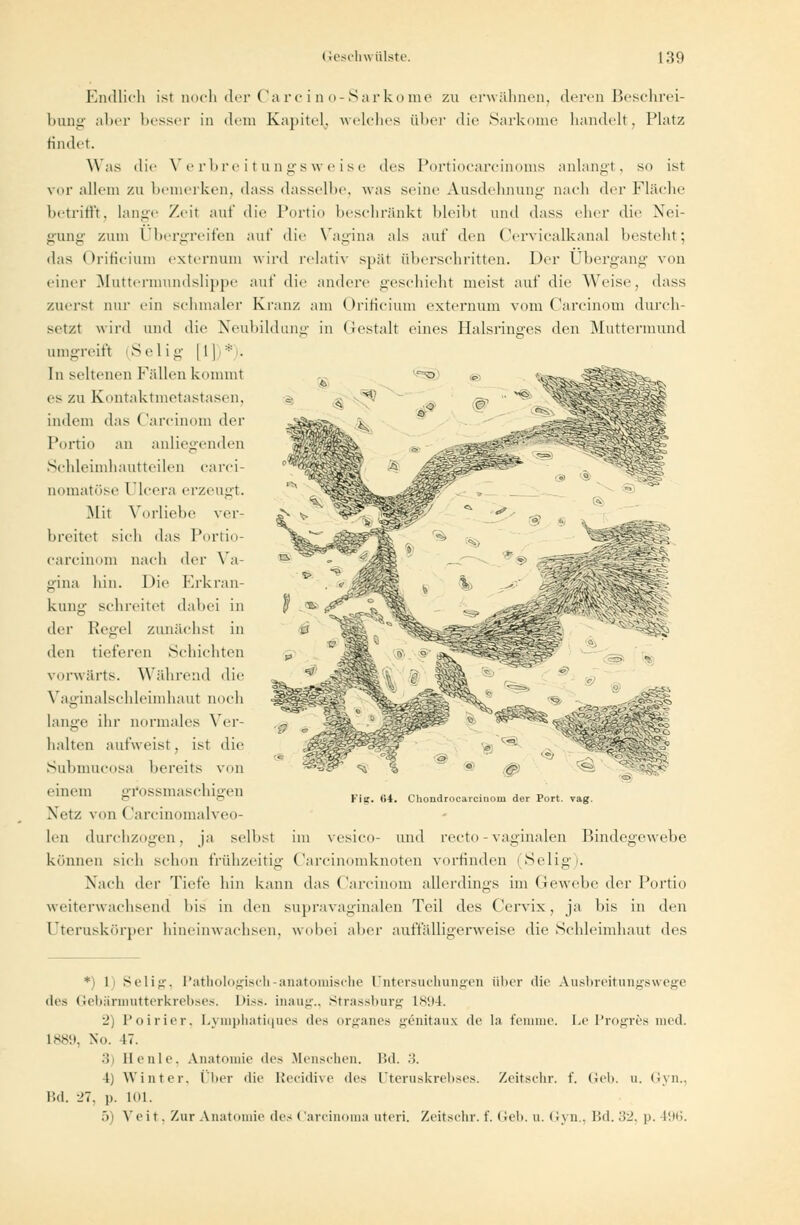 Endlich ist noch der Carcino-Sarkome zu erwähnen, deren Beschrei- bung aber besser in dem Kapitel, welches über die Sarkome handelt, Platz findet. Was die Verbreitungsweise des Portiocarcinoms anlangt, so ist vor allem zu bemerken, dass dasselbe, was seine Ausdehnung nach der Fläche betrifft, lange Zeil auf die Portio beschränkt bleibt und dass eher die Nei- gung zum Übergreifen auf die Vagina als auf den Cervicalkanal besteht; das ' hitieitim externum wird relativ spät überschritten. Der Übergang von einer Muttermundslippe auf die andere geschieht meist auf die Weise, dass zuerst nur ein schmaler Kranz am Orificium externum vom Carcinom durch- setzt wird und die Neubildung in Gestalt eines Halsringres den Muttermund umgreift [Selig [1])*)- In seltenen Fidlen kommt es zu Ivontaktmetastasen. indem das Carcinom der Portio an anliegenden Schleimhautteilen carci- Qomatöse Ulcera erzeugt. Mit Vorliebe ver- breitet sich das Portio- carcinom nach der Va- gina hin. Die Erkran- kung schreite! dabei in der Regel zunächst in den tieferen Schichten vorwärts. Während die KiL'. 64. Chondrocarcinom der Port. vag. Vaginalschleimhaut noch lange ihr normales Ver- halten aufweist , ist die Submucosa bereits von einem gfossmaschigen Netz von Carcinomalveo- li-ii durchzogen, ja selbst im vesico- und recto-vaginalen Bindegewebe können sich schon frühzeitig Carcinomknoten vorfinden (Selig). Nach der Tiefe hin kann das Carcinom allerdings im Gewebe der Portio weiterwachsend Ins in den supravaginalen Teil des Cervix, ja bis in den Uteruskörper hineinwachsen, wobei aber auffälligerweise die Schleimhaut des *) 1 Selig, Pathologisch-anatomische Untersuchungen über die Ausbreitungswege des Gebärmutterkrebses. I>i.-s. inaug., Strassburg L894. 2) Poirier, Lymphatiques des organes genitaux de In femme. Le Progres med. 1889, No. 47. > Ilcnle. Anatomie des Menschen. Bd. •'!. I) Winter, über die Recidive des öteruskrebses. Zeitschr. f. (ich. u. Gyn., IUI. 27, p. KU. .)i Veit, Zur Anatomie des Carcinoma uteri. Zeitschr.f. Geb. u. Gyn., Bd. 32, p. !:••;.