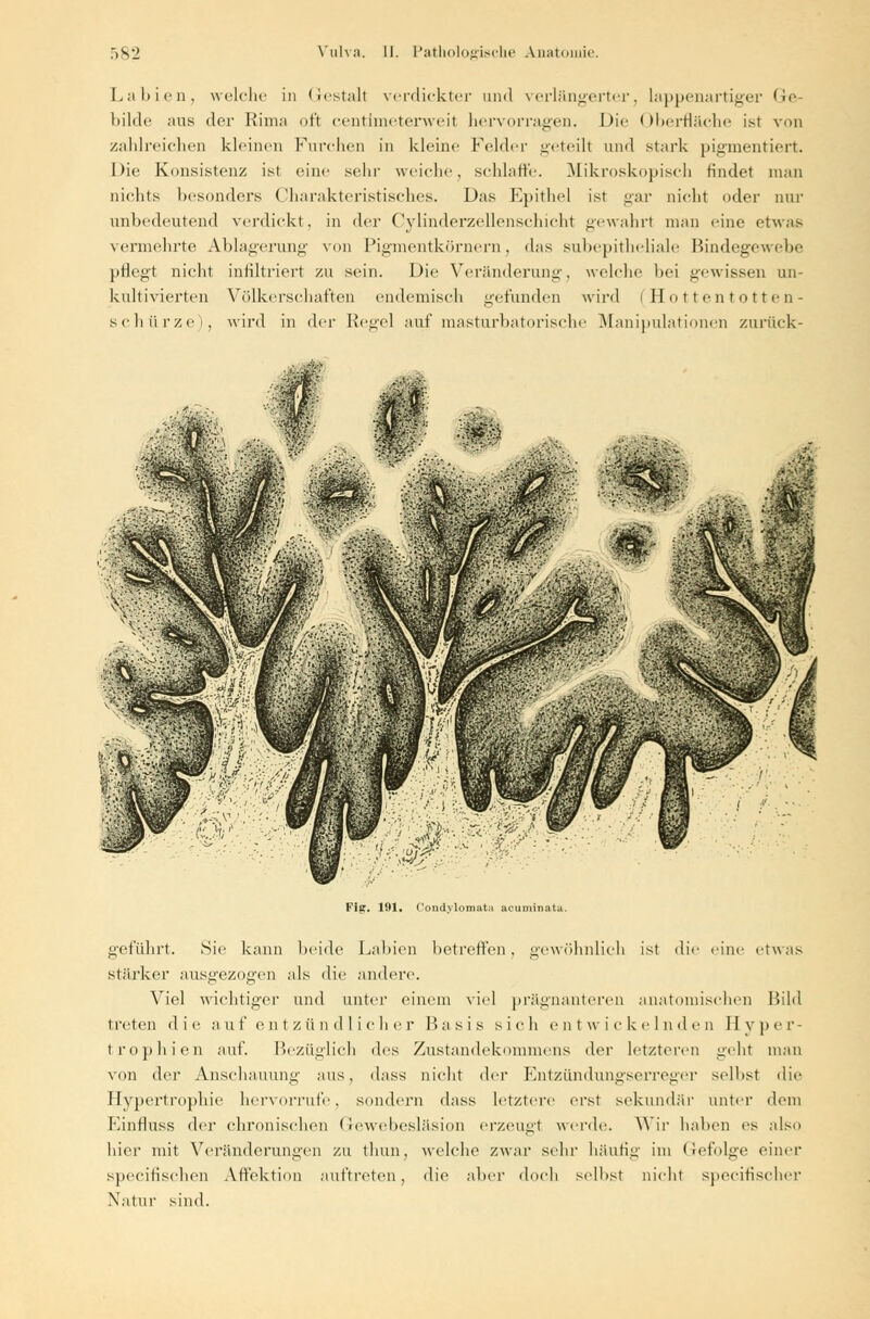 Labien, welche in Gestalt verdickter und verlängerter, lappenartiger Ge- bilde aus der Rinia oft centimeterweit hervorragen. Die Oberfläche ist von zahlreichen kleinen Furchen in kleine Felder geteilt und stark pigmentiert. Die Konsistenz ist eine sein- weiche, schlaffe. Mikroskopisch findet man nichts besonders Charakteristisches. Das Epithel ist gar nicht oder nur unbedeutend verdickt, in der Cylinderzellenschieht gewahrt man eine etwas vermehrte Ablagerung von Pigmentkörnern. das subepitheliale Bindegewebe pflegt nicht infiltriert zu sein. Die Veränderung, welche bei gewissen un- kultivierten Völkerschaften endemisch gefunden wird (Hottentotten- schürze), wird in der Regel auf masturbatorische Manipulationen zurück- Fi£. 191. Condylomata acuminatu. geführt. Sie kann beide Labien betreffen. gewöhnlich ist die eine etwas stärker ausgezogen als die andere. Viel wichtiger und unter einem viel prägnanteren anatomischen Bild treten die auf entzündlicher P> a s i s sich entwickelnden Hyper- trophien auf. Bezüglich des Zustandekommens der letzteren geht man von der Anschauung aus, dass nicht der Entzündungserreger selbst die Hypertrophie hervorrufe, sondern dass letztere erst sekundär unter dem Einfluss der chronischen Gewebesläsion erzeugt werde. Wir haben es also hier mit Veränderungen zu thun, welche zwar sehr häufig im Gefolge einer speeifischen Affektion auftreten, die aber doch selbst nicht speeifischer Natur sind.