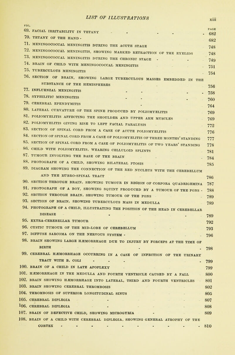 PAGE 682 682 748 748 749 09. FACIAL IRRITABILITY IN TETANY - 70. TETANY 01? THE HAND - 71. MENINGOCOCCAL MENINGITIS DURING THE ACUTE STAGE 72. MENINGOCOCCAL MENINGITIS, SHOWING MARKED RETRACTION OF THE EYELIDS 73. MENINGOCOCCAL MENINGITIS DURING THE CHRONIC STAGE - 74. BRAIN OP CHILD WITH MENINGOCOCCAL MENINGITIS 751 75. TUBERCULOUS MENINGITIS 76. SECTION OP BRAIN. SHOWING LARGE TUBERCULOUS MASSES EMBEDDED IN THE SUBSTANCE OP THE HEMISPHERES neo 77. INFLUENZAL MENINGITIS 78. SYPHILITIC MENINGITIS 79. CEREBRAL EPENDYMITIS 80. LATERAL CURVATURE OP THE SPINE PRODUCED BY POLIOMYELITIS 81. POLIOMYELITIS AFFECTING THE SHOULDER AND UPPER ARM MUSCLES 82. POLIOMYELITIS GIVING RISE TO LEFT FACIAL PARALYSIS 772 83. SECTION OF SPINAL CORD PROM A CASE OP ACUTE POLIOMYELITIS 776 84. SECTION OP SPINAL CORD FROM A CASE OF POLIOMYELITIS OF THREE MONTHS' STANDING 777 85. SECTION OF SPINAL CORD FROM A CASE OF POLIOMYELITIS OF TWO YEARS' STANDING 778 86. CHILD WITH POLIOMYELITIS, WEARING CELLULOID SPLINTS 781 87. TUMOUR INVOLVING THE BASE OF THE BRAIN 88. PHOTOGRAPH OF A CHILD, SHOWING BILATERAL PTOSIS 89. DIAGRAM SHOWING THE CONNECTION OF THE RED NUCLEUS WITH THE CEREBELLUM AND THE RUBRO-SPINAL TRACT 754 758 760 764 769 769 784 785 786 788 789 789 789 798 90. SECTION THROUGH BRAIN, SHOWING TUMOUR IN REGION OP CORPORA QUADRIGEMINA 787 91. PHOTOGRAPH OP A BOY, SHOWING SQUINT PRODUCED BY A TUMOUR OF THE PONS - 92. SECTION THROUGH BRAIN, SHOWING TUMOUR OF THE PONS 93. SECTION OF BRAIN, SHOWING TUBERCULOUS MASS IN MEDULLA 94. PHOTOGRAPH OF A CHILD, ILLUSTRATING THE POSITION OF THE HEAD IN CEREBELLAR DISEASE 95. EXTRA-CEREBELLAR TUMOUR 799 96. CYSTIC TUMOUR OP THE MID-LOBE OF CEREBELLUM 793 97. DIFFUSE SARCOMA ON THE NERVOUS SYSTEM - 796 98. BRAIN SHOWING LABGE HEMORRHAGE DUE TO INJURY BY FORCEPS AT THE TIME OF BIRTH 99. CEREBRAL HEMORRHAGE OCCURRING IN A CASE OF INFECTION OP THE URINARY TRACT WITH B. COLI ... . 799 100. BRAIN OF A CHILD IN LATE APOPLEXY 799 101. HEMORRHAGE IN THE MEDULLA AND FOURTH VENTRICLE CAUSED BY A PALL 800 102. BRAIN SHOWING HEMORRHAGE INTO LATERAL, THIRD AND FOURTH VENTRICLES 801 103. BRAIN SHOWING CEREBRAL THROMBOSIS 802 104. THROMBOSIS OP SUPERIOR LONGITUDINAL SINUS 805 105. CEREBRAL DIPLEGIA - 807 106. CEREBRAL DIPLEGIA . 808 107. BRAIN OF DEFECTIVE CHILD, SHOWING MICROGYRIA - 809 108. BRAIN OF A CHILD WITH CEREBRAL DIPLEGIA, SHOWING GENERAL ATROPHY OP THE CORTEX .......... 810