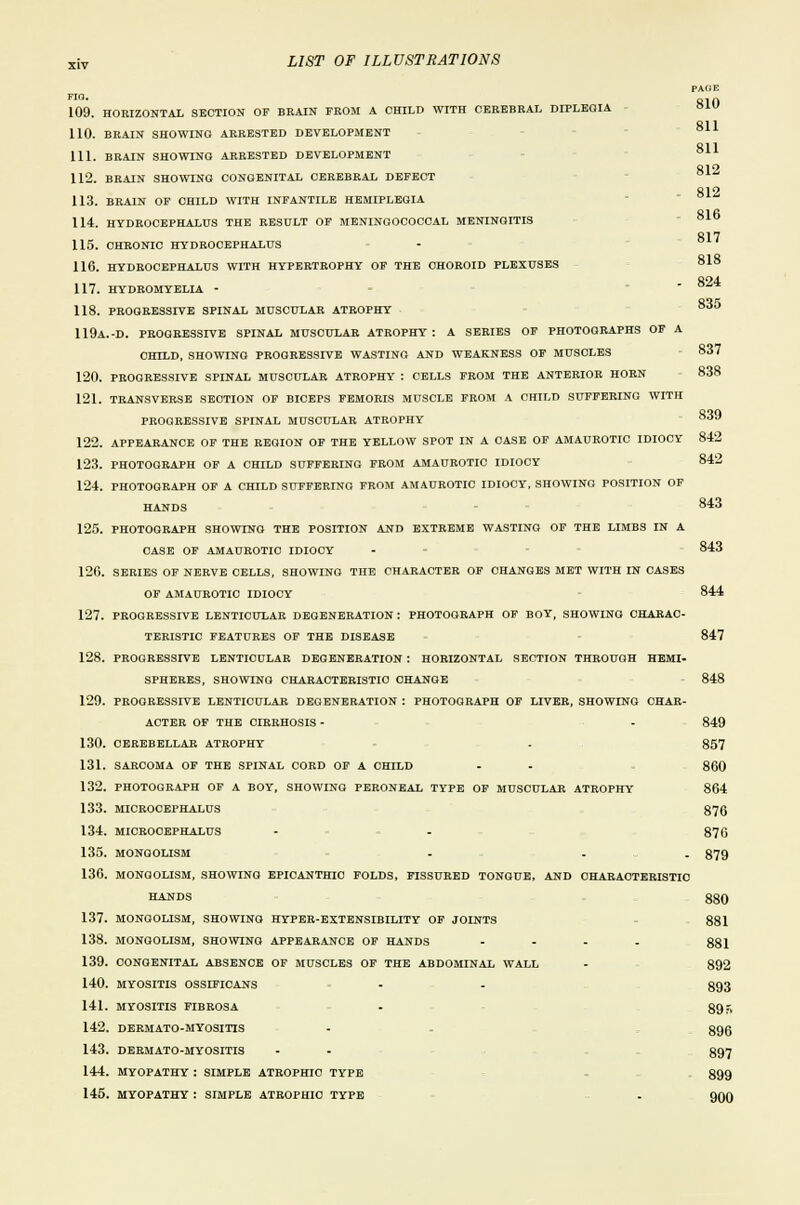 PACIE 810 811 811 812 812 816 817 818 824 835 838 839 843 843 844 109. HORIZONTAL SECTION OF BRAIN FROM A CHILD WITH CEREBRAL DIPLEGIA 110. BRAIN SHOWING ARRESTED DEVELOPMENT 111. BRAIN SHOWING ARRESTED DEVELOPMENT 112. BRAIN SHOWING CONGENITAL CEREBRAL DEFECT 113. BRAIN OF CHILD WITH INFANTILE HEMIPLEGIA 114. HYDROCEPHALUS THE RESULT OF MENINGOCOCCAL MENINGITIS 115. CHRONIC HYDROCEPHALUS 116. HYDROCEPHALUS WITH HYPERTROPHY OF THE CHOROID PLEXUSES 117. HYDROMYELIA - 118. PROGRESSIVE SPINAL MUSCULAR ATROPHY 119A.-D. PROGRESSIVE SPINAL MUSCULAR ATROPHY : A SERIES OF PHOTOGRAPHS OF A CHILD, SHOWING PROGRESSIVE WASTING AND WEAKNESS OF MUSCLES 837 120. PROGRESSIVE SPINAL MUSCULAR ATROPHY : CELLS FROM THE ANTERIOR HORN 121. TRANSVERSE SECTION OF BICEPS FEMORIS MUSCLE FROM A CHILD SUFFERING WITH PROGRESSIVE SPINAL MUSCULAR ATROPHY 122. APPEARANCE OF THE REGION OF THE YELLOW SPOT IN A CASE OF AMAUROTIC IDIOCY 842 123. PHOTOGRAPH OF A CHILD SUFFERING FROM AMAUROTIC IDIOCY 842 124. PHOTOGRAPH OF A CHILD SUFFERING FROM AMAUROTIC IDIOCY, SHOWING POSITION OF HANDS 125. PHOTOGRAPH SHOWING THE POSITION AND EXTREME WASTING OF THE LIMBS IN A CASE OF AMAUROTIC IDIOCY 126. SERIES OF NERVE CELLS, SHOWING THE CHARACTER OF CHANGES MET WITH IN CASES OF AMAUROTIC IDIOCY 127. PROGRESSIVE LENTICULAR DEGENERATION: PHOTOGRAPH OF BOY, SHOWING CHARAC- TERISTIC FEATURES OF THE DISEASE 847 128. PROGRESSIVE LENTICULAR DEGENERATION : HORIZONTAL SECTION THROUGH HEMI- SPHERES, SHOWING CHARACTERISTIC CHANGE 848 129. PROGRESSIVE LENTICULAR DEGENERATION : PHOTOGRAPH OF LIVER, SHOWING CHAR- ACTER OF THE CIRRHOSIS - - 849 130. CEREBELLAR ATROPHY . 857 131. SARCOMA OF THE SPINAL CORD OF A CHILD - - 860 132. PHOTOGRAPH OF A BOY, SHOWING PERONEAL TYPE OF MUSCULAR ATROPHY 864 133. MICROCEPHALUS 876 134. MICROCEPHALUS - - 876 135. MONGOLISM . . . 879 136. MONGOLISM, SHOWING EPICANTHIO FOLDS, FISSURED TONGUE, AND CHARACTERISTIC HANDS 880 137. MONGOLISM, SHOWING HYPER-EXTENSIBILITY OF JOINTS 881 138. MONGOLISM, SHOWING APPEARANCE OF HANDS .... 881 139. CONGENITAL ABSENCE OF MUSCLES OF THE ABDOMINAL WALL - 892 140. MYOSITIS OSSIFICANS - - 893 141. MYOSITIS FIBROSA - 89 r. 142. DERMATO-MYOSITIS - 896 143. DERMATO-MYOSITIS - - 897 144. MYOPATHY : SIMPLE ATROPHIC TYPE 899 145. MYOPATHY : SIMPLE ATROPHIC TYPE . g()Q