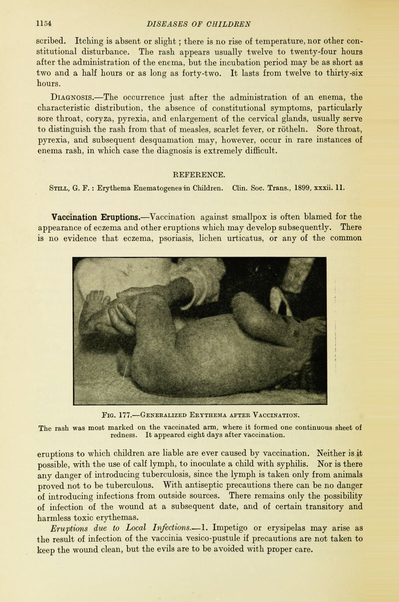 scribed. Itching is absent or slight; there is no rise of temperature, nor other con- stitutional disturbance. The rash appears usually twelve to twenty-four hours after the administration of the enema, but the incubation period may be as short as two and a half hours or as long as forty-two. It lasts from twelve to thirty-six hours. Diagnosis.—The occurrence just after the administration of an enema, the characteristic distribution, the absence of constitutional symptoms, particularly sore throat, coryza, pyrexia, and enlargement of the cervical glands, usually serve to distinguish the rash from that of measles, scarlet fever, or rotheln. Sore throat, pyrexia, and subsequent desquamation may, however, occur in rare instances of enema rash, in which case the diagnosis is extremely difficult. REFERENCE. Still, G. F. : Erythema Enematogenes in Childien. Clin. Soc. Trans., 1899, xxxii. 11. Vaccination Eruptions.—Vaccination against smallpox is often blamed for the appearance of eczema and other eruptions which may develop subsequently. There is no evidence that eczema, psoriasis, lichen urticatus, or any of the common Fig. 177.—Generalized Erythema after Vaccination. The rash was most marked on the vaccinated arm, where it formed one continuous sheet of redness. It appeared eight days after vaccination. eruptions to which children are liable are ever caused by vaccination. Neither is it possible, with the use of calf lymph, to inoculate a child with syphilis. Nor is there any danger of introducing tuberculosis, since the lymph is taken only from animals proved not to be tuberculous. With antiseptic precautions there can be no danger of introducing infections from outside sources. There remains only the possibility of infection of the wound at a subsequent date, and of certain transitory and harmless toxic erythemas. Eruptions due to Local Infections—1. Impetigo or erysipelas may arise as the result of infection of the vaccinia vesico-pustule if precautions are not taken to keep the wound clean, but the evils are to be avoided with proper care.