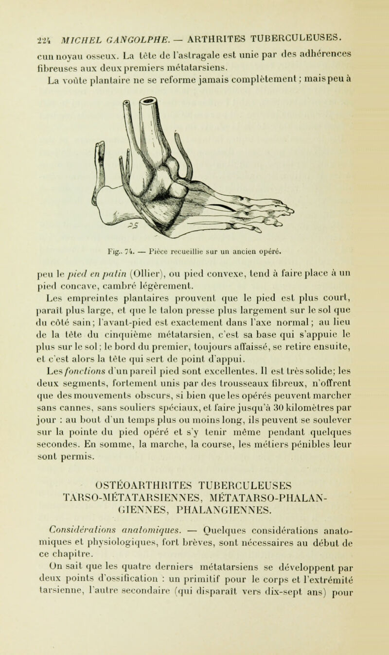 cun noyau osseux. La tète de l'astragale est unie par des adhérences fibreuses aux deux premiers métatarsiens. La voûte plantaire ne se reforme jamais complètement ; mais peu à Fig.. 74. — Pièce recueillie sur un ancien opéré. peu le pied en patin (Ollier), ou pied convexe, tend à faire place à un |iie<l concave, cambré légèrement. Les empreintes plantaires prouvent que le pied est plus court, parait plus large, et que le talon presse plus largement sur le sol que du côté sain; l'avant-pied est exactement dans Taxe normal; au lieu de la tète du cinquième métatarsien, c'est sa base qui s'appuie le plus sur le sol : le bord du premier, toujours affaissé, se retire ensuite, et c'est alors la tète qui sert de point d'appui. Les fonctions d'un pareil pied sont excellentes. Il est très solide; les deux segments, fortement unis par des trousseaux fibreux, n'offrent que des mouvements obscurs, si bien que les opérés peuvent marcher sans cannes, sans souliers spéciaux, et l'aire jusqu'à 30 kilomètres par jour : au bout d'un temps plus ou moins long, ils peuvent se soulever sur la pointe du pied opéré et s'y tenir même pendant quelques secondes. En somme, la marche, la course, les métiers pénibles leur sont permis. OSTÉOARTHRITES TUBERCULEUSES TÀRSO-MÉTATARSIENNES, MÉTATARSO-PHALAN- GIENNES, PHALANGIENNES. Considérations anatomiques. — Quelques considérations anato- miques et physiologiques, fort brèves, sont nécessaires au début de ce chapitre. On sait que les quatre derniers métatarsiens se développent par deux points d'ossification : un primitif pour le corps et l'extrémité tarsienne, l'autre secondaire (qui disparaît vers dix-sept ans) pour