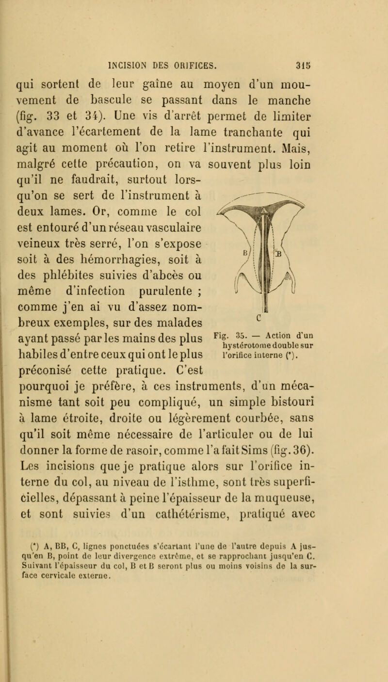 qui sortent de leur gaine au moyen d'un mou- vement de bascule se passant dans le manche (fig. 33 et 34). Une vis d'arrêt permet de limiter d'avance l'écartement de la lame tranchante qui agit au moment où l'on retire l'instrument. Mais, malgré cette précaution, on va souvent plus loin qu'il ne faudrait, surtout lors- qu'on se sert de l'instrument à deux lames. Or, comme le col est entouré d'un réseau vasculaire veineux très serré, l'on s'expose soit à des hémorrhagies, soit à des phlébites suivies d'abcès ou même d'infection purulente ; comme j'en ai vu d'assez nom- breux exemples, sur des malades ayant passé parles mains des plus habiles d'entre ceux qui ont le plus préconisé cette pratique. C'est pourquoi je préfère, à ces instruments, d'un méca- nisme tant soit peu compliqué, un simple bistouri à lame étroite, droite ou légèrement courbée, sans qu'il soit même nécessaire de l'articuler ou de lui donner la forme de rasoir, comme l'a fait Sims (fig. 36). Les incisions que je pratique alors sur l'orifice in- terne du col, au niveau de l'isthme, sont très superfi- cielles, dépassant à peine l'épaisseur de la muqueuse, et sont suivies d'un cathétérisme, pratiqué avec Fig. 35. — Action d'un hy stérotome double sur l'orifice interne (*). (*) A, BB, C, lignes ponctuées s'écarlant l'une de l'autre depuis A jus- qu'en B, point de leur divergence extrême, et se rapprochant jusqu'en C. Suivant l'épaisseur du col, B et B seront plus ou moins voisins de la sur- face cervicale externe.