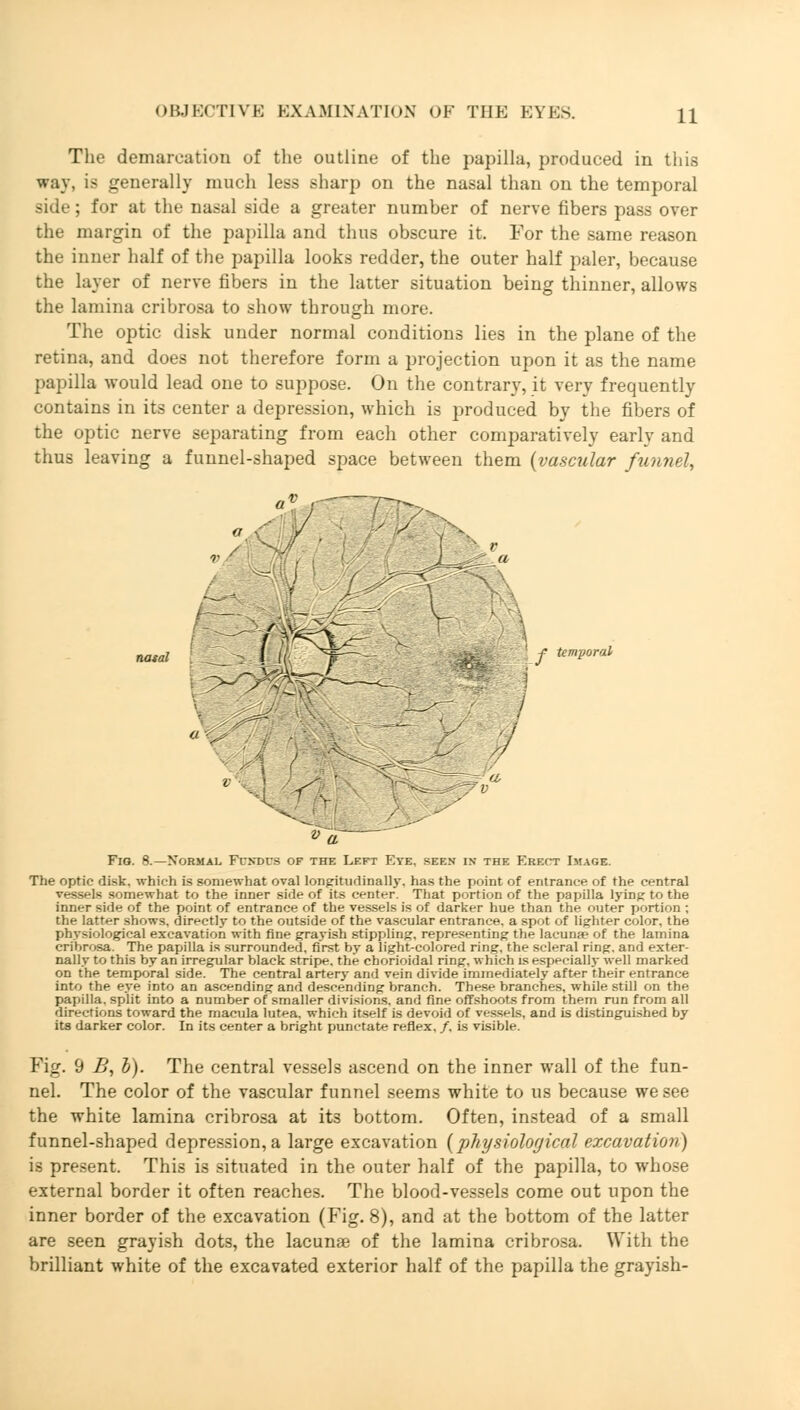 Tlie demarcation of the outline of the papilla, produced in this way, is generally much less sharp on the nasal than on the temporal side; for at the nasal side a greater number of nerve fibers pass over the margin of the papilla and thus obscure it. For the same reason the inner half of the papilla looks redder, the outer half paler, because the layer of nerve fibers in the latter situation being thinner, allows the lamina cribrosa to show through more. The optic disk under normal conditions lies in the plane of the retina, and does not therefore form a projection upon it as the name papilla would lead one to suppose. On the contrary, it very frequently contains in its center a depression, which is produced by the fibers of the optic nerve separating from each other comparatively early and thus leaving a funnel-shaped space between them (vascular funnel, ' f temporal i fj, < V V a Fig. 8.—Normal Fundus of the Left Eye. sees in the Erect Image. The optic disk, which is somewhat oval longitudinally, has the point of entrance of the central vessels somewhat to the inner side of its center. That portion of the papilla lying to the inner side of the point of entrance of the vessels is of darker hue than the outer portion ; the latter shows, directly to the outside of the vascular entrance, a spot of lighter color, the physiological excavation with fine grayish stippling, representing the lacuna? of the lamina cribrosa. The papilla is surrounded, first by a light-colored ring, the scleral ring, and exter- nally to this by an irregular black stripe, the chorioidal ring, which is especially well marked on the temporal side. The central artery and vein divide immediately after their entrance into the eye into an ascending and descending branch. These branches, while still on the papilla, split into a number of smaller divisions, and fine offshoots from them run from all directions toward the macula lutea, which itself is devoid of vessels, and is distinguished by its darker color. In its center a bright punctate reflex, /, is visible. Fig. 9 B, b). The central vessels ascend on the inner wall of the fun- nel. The color of the vascular funnel seems white to us because we see the white lamina cribrosa at its bottom. Often, instead of a small funnel-shaped depression, a large excavation (physiological excavation) is present. This is situated in the outer half of the papilla, to whose external border it often reaches. The blood-vessels come out upon the inner border of the excavation (Fig. 8), and at the bottom of the latter are seen grayish dots, the lacunae of the lamina cribrosa. With the brilliant white of the excavated exterior half of the papilla the grayish-