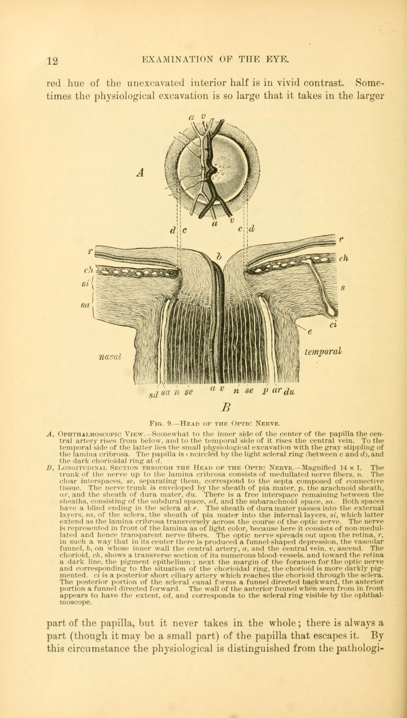 red hue of the unexcavated interior half is in vivid contrast. Some- times the physiological excavation is so large that it takes in the larger a v temporal sd sa  se ° v n se p ar^ii B Fig. 9.—Head of the Optic Nerve. A, Ophthalmoscopic View.-Somewhat to the inner side of the center of the papilla the cen- tral artery rises from below, and to the temporal side of it rises the central vein. To the temporal side of the latter lies the small physiological excavation with the gray stippling of tin' lamina cribrosa. The papilla is > ncircled by the light scleral ring (between c and d),and the dark- chorioidaJ ring at d. B, Longitudinal Section through the Head of the Optic Nekve. — Magnified 14 x 1. The Crunk of the nerve up to the lamina cribrosa consists of medullat'-d nerve fibers, n. The clear interspaces, se, separating them, correspond to the septa composed of connective tissue. The nerve trunk is enveloped by the sheath of pia mater, p, the arachnoid sheath, fir, and the sheath of dura mater, du. There is a free interspace remaining between the sheaths, consisting of the subdural space, sd, and the subarachnoid space, sa. Both spaces have a blind ending in the sclera at e. The sheath of dura mater passes into the external layers. sa, of the sclera, the sheath of pia mater into the internal layers, si, which latter extend as the lamina cribrosa transversely across the course of the optic nerve. The nerve is represented in front of the lamina as of light color, because here it consists of non-medul- lated and hence transparent nerve fibers. The optic nerve spreads out upon the ret ina. r, in such a way that in its center there is produced a tunnel shaped depression, the vascular funnel. /), on whose inner wall the central artery, a, and the central vein. v. ascend The chorioid, cA, shows a transverse section of its numerous blood-vessels, and toward the retina a dark line, the pigment epithelium; next the margm of the foramen for the optic nerve and corresponding to the situation of the Chorioida] ring, the chorioid is more darkly pig- mented, ct is a posterior short ciliary artery which reaches the chorioid through the sclera. The posterior portion of the scleral canal forms a funnel directed backward, the anterior portion a funnel directed forward. The wall of the anterior tunnel when seen from in front appears to have the extent, cd, and corresponds to the scleral ring visible by the ophthal- moscope. part of the papilla, but it never takes in the whole; there is always a part (though it may be a small part) of the papilla that escapes it. By this circumstance the physiological is distinguished from the pathologi-