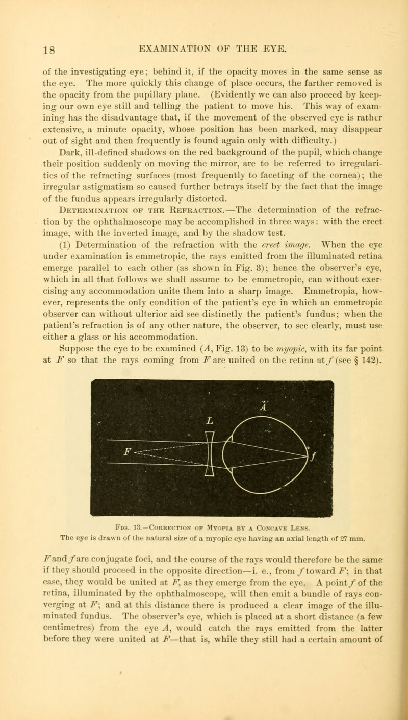 of the investigating eye; behind it, if the opacity moves in the same sense as the eye. The more quickly this change of place occurs, the farther removed is the opacity from the pupillary plane. (Evidently we can also proceed by keep- ing our own eye still and telling the patient to move his. This way of exam- ining has the disadvantage that, if the movement of the observed eye is rather extensive, a minute opacity, whose position has been marked, may disappear out of sight and then frequently is found again only with difficulty.) Dark, ill-defined shadows on the red background of the pupil, which change their position suddenly on moving the mirror, are to be referred to irregulari- ties of the refracting surfaces (most frequently to faceting of the cornea); the irregular astigmatism so caused further betrays itself by the fact that the image of the fundus appears irregularly distorted. Determination of the Refraction.—The determination of the refrac- tion by the ophthalmoscope may be accomplished in three ways: with the erect image, with the inverted image, and by the shadow test. (1) Determination of the refraction with the erect image. When the eye under examination is emmetropic, the rays emitted from the illuminated retina emerge parallel to each other (as shown in Fig. 3); hence the observer's eye, which in all that follows we shall assume to be emmetropic, can without exer- cising any accommodation unite them into a sharp image. Emmetropia, how- ever, represents the only condition of the patient's eye in which an emmetropic observer can without ulterior aid see distinctly the patient's fundus; when the patient's refraction is of any other nature, the observer, to see clearly, must use either a glass or his accommodation. Suppose the eye to be examined (A, Fig. 13) to be myopic, with its far point at F so that the rays coming from i^are united on the retina at./'(see § 142). Fig. 13. —Correction of Myopia by a Concave Lens. The eye is drawn of the natural size of a myopic eye having an axial length of 27 mm. /•'and/arc conjugate foci, and the course of the rays would therefore be the same if the; should proceed in the opposite direction—i. e., from /toward F; in that case, they would be united at F, as they emerge from the eye. A point/of the ntina, illuminated by the ophthalmoscope^ will then emit a bundle of rays con- verging at F\ and at this distance there is produced a clear image of the illu- minated fundus. The observer's eye, which is placed at a short distance (a few centimetres) from the eye A, would catch the rays emitted from the latter before they were united at F—that is, while they still had a certain amount of