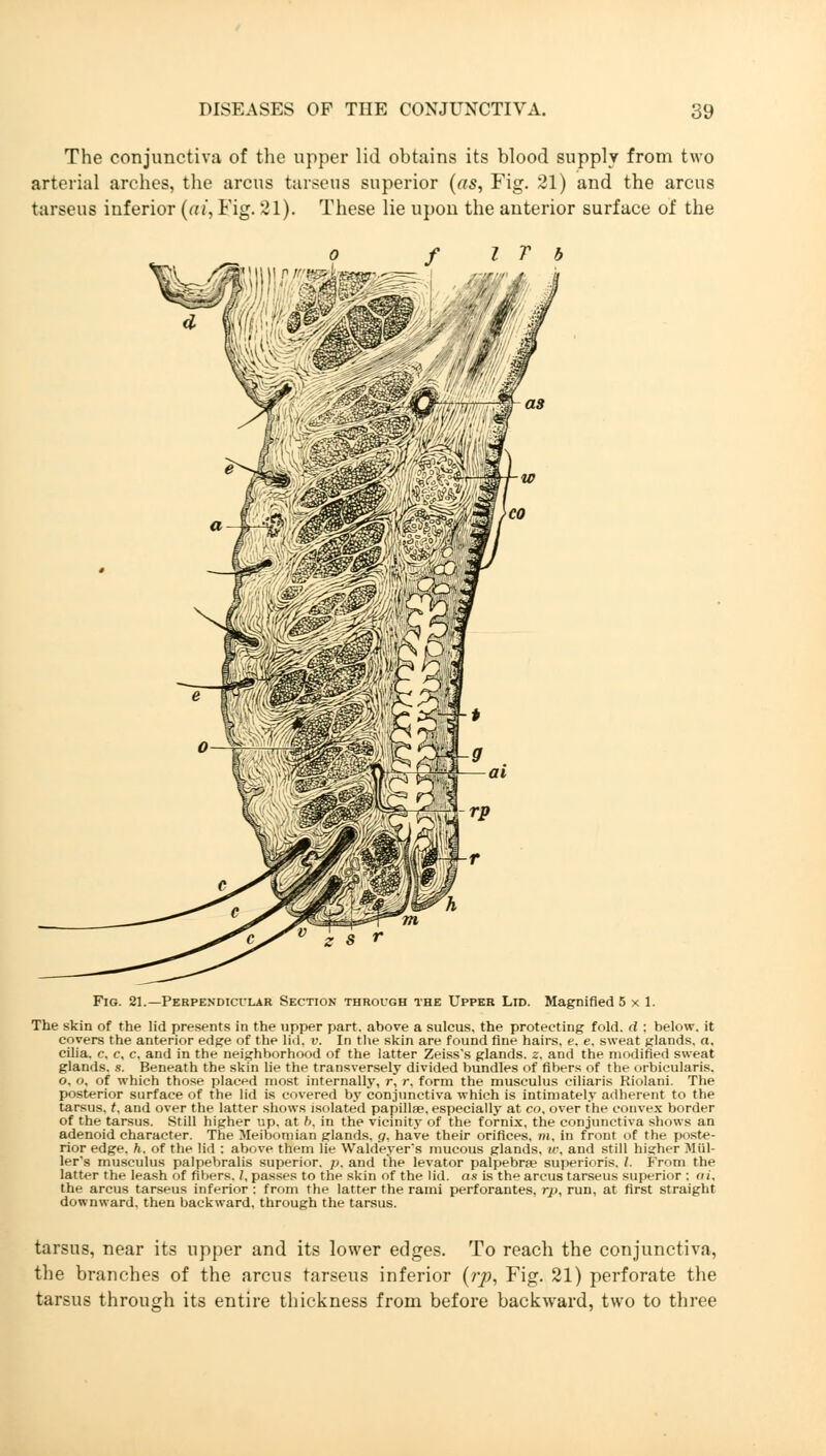 The conjunctiva of the upper lid obtains its blood supply from two arterial arches, the arcus tarseus superior (as, Fig. 21) and the arcus tarseus inferior (at, Fig. 21). These lie upon the anterior surface of the Fig. 21.—Perpendicular Section through the Upper Lid. Magnified 5x1. The skin of the lid presents in the upper part, above a sulcus, the protecting fold, d : below, it covers the anterior edge of the lid, i». In the skin are found fine hairs, e. e, sweat glands, a, cilia, e, c, c, and in the neighborhood of the latter Zeiss's glands, z. and the modified sweat glands, s. Beneath the skin lie the transversely divided bundles of fibers of the orbicularis. o, o, of which those placed most internally, r, r. form the musculus ciliaris Riolani. The posterior surface of the lid is covered by conjunctiva which is intimately adherent to the tarsus, t, and over the latter shows isolated papillae, especially at co, over the convex border of the tarsus. Still higher up. at b, in the vicinity of the fornix, the conjunctiva shows an adenoid character. The Meibomian glands, g. have their orifices, m, in front of the poste- rior edge. h. of the lid : above them lie Waldeyer's mucous glands, ir, and still higher Mai- ler's musculus palpebralis superior, p. and the levator palpebrae superioris. /. From the lattt-r the leash of fibers. I, passes to the skin of the lid. as is the arcus tarseus superior : ai, the arcus tarseus inferior : from the latter the rami perforantes, rp, run, at first straight downward, then backward, through the tarsus. tarsus, near its upper and its lower edges. To reach the conjunctiva, the branches of the arcus tarseus inferior (rp, Fig. 21) perforate the tarsus through its entire thickness from before backward, two to three