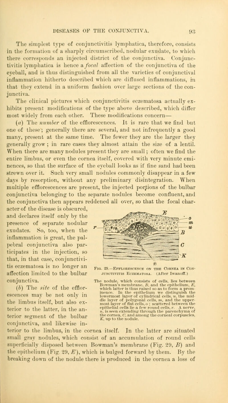 The simplest type of conjunctivitis lymphatica, therefore, consists in the formation of ;i sharply circumscribed, nodular exudate, to which there corresponds an injected district of the conjunctiva. Conjunc- tivitis lymphatica is hence a, focal affection of the conjunctiva of the eyeball, and is thus distinguished from all the varieties of conjunctival inflammation hitherto described which are diffused inflammations, in that they extend in a uniform fashion over large sections of the con- junctiva. The clinical pictures which conjunctivitis eczematosa actually ex- hibits present modifications of the type above described, which differ most widely from each other. These modifications concern— (a) The number of the efflorescences. It is rare that we find but one of these; generally there are several, and not infrequently a good many, present at the same time. The fewer they are the larger they generally grow ; in rare cases they almost attain the size of a lentil. When there are many nodules present they are small; often we find the entire limbus, or even the cornea itself, covered with very minute emi- nences, so that the surface of the eyeball looks as if fine sand had been strewn over it. Such very small nodules commonly disappear in a few days by resorption, without any preliminary disintegration. When multiple efflorescences are present, the injected portions of the bulbar conjunctiva belonging to the separate nodules become confluent, and the conjunctiva then appears reddened all over, so that the focal char- acter of the disease is obscured, and declares itself only by the presence of separate nodular exudates. So, too, when the inflammation is great, the pal- pebral conjunctiva also par- ticipates in the injection, so that, in that case, conjunctivi- tis eczematosa is no longer an affection limited to the bulbar conjunctiva. (b) The site of the efflor- escences may be not only in the limbus itself, but also ex- terior to the latter, in the an- terior segment of the bulbar conjunctiva, and likewise in- terior to the limbus, in the cornea itself. In the latter are situated small gray nodules, which consist of an accumulation of round cells superficially disposed between Bowman's membrane (Fig. 29, B) and the epithelium (Fig. 29, E), which is bulged forward by them. By the breaking down of the nodule there is produced in the cornea a loss of Fig. 29.—Efflorescence on the Cornea in Con- junctivitis Eczematosa. (After Iwanoff.) The nodule, which consists of cells, lies between Bowman's membrane, B, and the epithelium, E, which latter is thus raised so as to form a prom- inence. In the epithelium we distinguish the lowermost layer of cylindrical cells, it, the mid- dle layer of polygonal cells, wi, and the upper- most layer of flat cells, o ; scattered between the epithelial cells lie a few round cells, r. A nerve, n. is seen extending through the parenchyma of the cornea. C. and among the corneal corpuscles, K, up to the nodule.