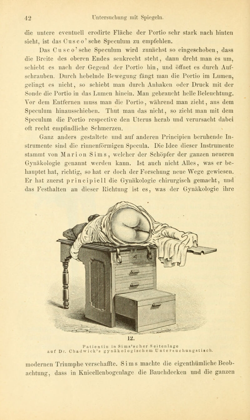 die untere eventuell erodirte Fläche der Portio sehr stark nach hinten sieht, ist das Cusco'sche Speculum zu empfehlen. Das Cu sco'sehe Speculum wird zunächst so eingeschoben, dass die Breite des oberen Endes senkrecht steht, dann dreht man es um, schiebt es nach der Gegend der Portio hin, und öffnet es durch Auf- schrauben. Durch hebelnde Bewegung fängt man die Portio im Lumen, gelingt es nicht, so schiebt man durch Anhaken oder Druck mit der Sonde die Portio in das Lumen hinein. Man gebraucht helle Beleuchtung. Vor dem Entfernen muss. man die Portio, während man zieht, aus dem Speculum hinausschieben. Thut man das nicht, so zieht man mit dem Speculum die Portio respective den Uterus herab und verursacht dabei oft recht empfindliche Schmerzen. Ganz anders gestaltete und auf anderen Principien beruhende In- strumente sind die rinnenförmigen Specula. Die Idee dieser Instrumente stammt von Marion Sims, welcher der Schöpfer der ganzen neueren Gynäkologie genannt werden kann. Ist auch nicht Alles, was er be- hauptet hat, richtig, so hat er doch der Forschung neue Wege gewiesen. Er hat zuerst principiell die Gynäkologie chirurgisch gemacht, und das Festhalten an dieser Richtung ist es, was der Gynäkologie ihre Patientin in Sims'scher S e i t e n 1 a g e auf Dr. Chadwick's gynäkologischem Untersuchungstisch. modernen Triumphe verschaffte. Sims machte die eigentümliche Beob- achtung, dass in Knieellenbogenlage die Bauchdecken und die ganzen