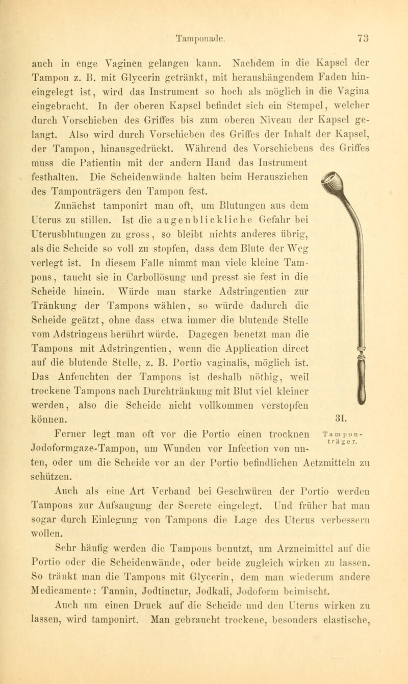 auch in enge Vaginen gelangen kann. Nachdem in die Kapsel der Tampon z. B. mit Glycerin getränkt, mit heraushängendem Faden hin- eingelegt ist, wird das Instrument so hoch als möglich in die Vagina eingebracht. In der oberen Kapsel befindet sich ein Stempel, welcher durch Vorschieben des Griffes bis zum oberen Niveau der Kapsel ge- langt. Also wird durch Vorschieben des Griffes der Inhalt der Kapsel, der Tampon, hinausgedrückt. Während des Vorschiebens des Griffes muss die Patientin mit der andern Hand das Instrument festhalten. Die Scheidenwände halten beim Herausziehen des Tamponträgers den Tampon fest. Zunächst tamponirt man oft, um Blutungen aus dem Uterus zu stillen. Ist die augenblickliche Gefahr bei Uterusblutungen zu gross, so bleibt nichts anderes übrig, als die Scheide so voll zu stopfen, dass dem Blute der Weg verlegt ist. In diesem Falle nimmt man viele kleine Tam- pons , taucht sie in Carbollösung und presst sie fest in die Scheide hinein. Würde man starke Adstringentien zur Tränkung der Tampons wählen, so würde dadurch die Scheide geätzt, ohne dass etwa immer die blutende Stelle vom Adstringens berührt würde. Dagegen benetzt man die Tampons mit Adstringentien, wenn die Application direct auf die blutende Stelle, z. B. Portio vaginalis, möglich ist. Das Anfeuchten der Tampons ist deshalb nöthig, weil trockene Tampons nach Durchtränkung mit Blut viel kleiner werden, also die Scheide nicht vollkommen verstopfen können. 31. Ferner legt man oft vor die Portio einen trocknen Jodoformgaze-Tampon, um Wunden vor Infection von un- ten, oder um die Scheide vor an der Portio befindlichen Aetzmitteln zu schützen. Auch als eine Art Verband bei Geschwüren der Portio werden Tampons zur Aufsaugung der Secrete eingelegt. Und früher hat man sogar durch Einlegung von Tampons die Lage des Uterus verbessern wollen. Sehr häufig wrerden die Tampons benutzt, um Arzneimittel auf die Portio oder die Scheidenwände, oder beide zugleich wirken zu lassen. So tränkt man die Tampons mit Glycerin, dem man wiederum andere Medicamente: Tannin, Jodtinctur, Jodkali, Jodoform beimischt. Auch um einen Druck auf die Seheide und den Uterus wirken zu lassen, wird tamponirt. Man gebraucht troekene, besonders elastische, Tampon' träger.