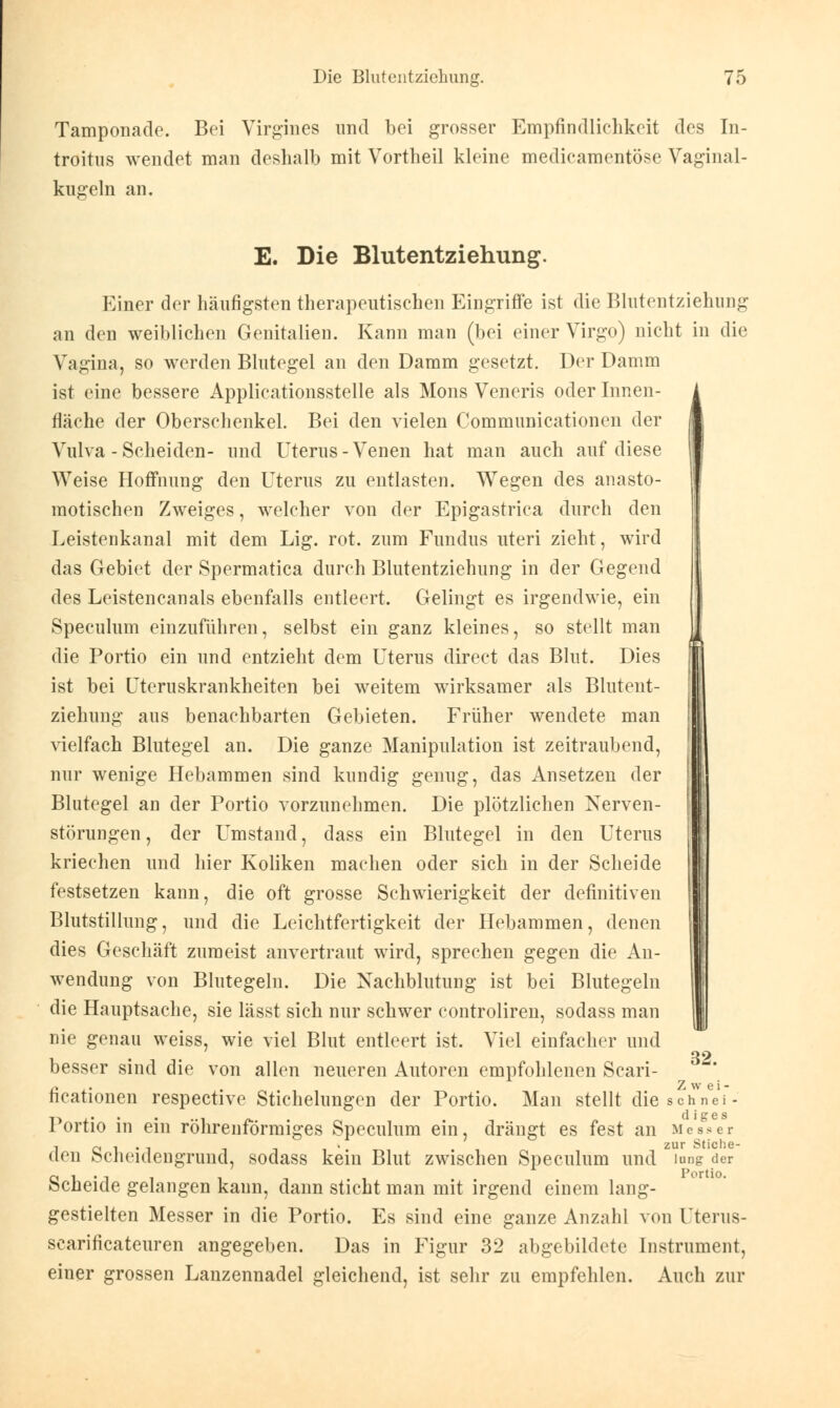 Tamponade. Bei Virgines und bei grosser Empfindlichkeit des In- troitus wendet man deshalb mit Vortheil kleine medicamentöse Vaginal- kugeln an. E. Die Blutentziehung. Einer der häufigsten therapeutischen Eingriffe ist die Blutentziehung an den weiblichen Genitalien. Kann man (bei einer Yirgo) nicht in die Vagina, so werden Blutegel an den Damm gesetzt. Der Damm ist eine bessere Applicationsstelle als Mons Veneris oder Innen- fläche der Oberschenkel. Bei den vielen Communicationen der Vulva - Scheiden- und Uterus-Venen hat man auch auf diese Weise Hoffnung den Uterus zu entlasten. Wegen des anasto- motischen Zweiges, welcher von der Epigastrica durch den Leistenkanal mit dem Lig. rot. zum Fundus uteri zieht, wird das Gebiet der Spermatica durch Blutentziehung in der Gegend des Leistencanals ebenfalls entleert. Gelingt es irgendwie, ein Speculum einzuführen, selbst ein ganz kleines, so stellt man die Portio ein und entzieht dem Uterus direct das Blut. Dies ist bei Uteruskrankheiten bei weitem wirksamer als Blutent- ziehung aus benachbarten Gebieten. Früher wendete man vielfach Blutegel an. Die ganze Manipulation ist zeitraubend, nur wenige Hebammen sind kundig genug, das Ansetzen der Blutegel an der Portio vorzunehmen. Die plötzlichen Nerven- störungen , der Umstand, dass ein Blutegel in den Uterus kriechen und hier Koliken machen oder sich in der Scheide festsetzen kann, die oft grosse Schwierigkeit der definitiven Blutstillung, und die Leichtfertigkeit der Hebammen, denen dies Geschäft zumeist anvertraut wird, sprechen gegen die An- wendung von Blutegeln. Die Nachblutung ist bei Blutegeln die Hauptsache, sie lässt sich nur schwer controliren, sodass man nie genau weiss, wie viel Blut entleert ist. Viel einfacher und besser sind die von allen neueren Autoren empfohlenen Scari- ficationen respective Stichelungen der Portio. Man stellt die schnei- Portio in ein röhrenförmiges Speculum ein, drängt es fest an Messer i o i • i t t • zur Stiche- üen öcheidengrund, sodass kein Blut zwischen Speculum und lang der Scheide gelangen kann, dann sticht man mit irgend einem lang- gestielten Messer in die Portio. Es sind eine ganze Anzahl von Uterus- scarificateuren angegeben. Das in Figur 32 abgebildete Instrument, einer grossen Lanzennadel gleichend, ist sehr zu empfehlen. Auch zur