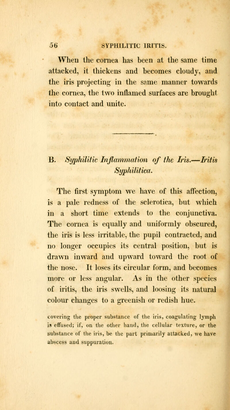 When the cornea has been at the same time attacked, it thickens and becomes cloudy, and the iris projecting in the same manner towards the cornea, the two inflamed surfaces are brought into contact and unite. B. Syphilitic Inflammation of the Iris.—Iritis Syphilitica. The first symptom we have of this affection, is a pale redness of the sclerotica, but which in a short time extends to the conjunctiva. The cornea is equally and uniformly obscured, the iris is less irritable, the pupil contracted, and no longer occupies its central position, but is drawn inward and upward toward the root of the nose. It loses its circular form, and becomes more or less angular. As in the other species of iritis, the iris swells, and loosing its natural colour changes to a greenish or redish hue. covering the proper substance of the iris, coagulating lymph is effused; if, on the other hand, the cellular texture, or the substance of the iris, be the part primarily attacked, we have abscess and suppuration.