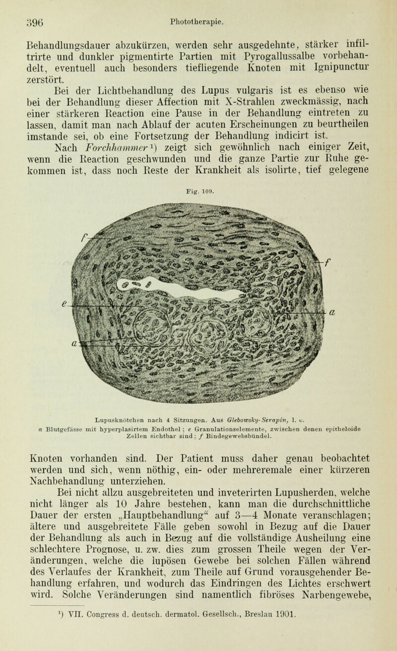 Behandlungsdauer abzukürzen, werden sehr ausgedehnte, stärker infil- trirte und dunkler pigmentirte Partien mit Pyrogallussalbe vorbehan- delt, eventuell auch besonders tiefliegende Knoten mit Ignipunctur zerstört. Bei der Lichtbehandlung des Lupus vulgaris ist es ebenso wie bei der Behandlung dieser Affection mit X-Strahlen zweckmässig, nach einer stärkeren Reaction eine Pause in der Behandlung eintreten zu lassen, damit man nach Ablauf der acuten Erscheinungen zu beurtheilen imstande sei, ob eine Fortsetzung der Behandlung indicirt ist. Nach Forchhammer1) zeigt sich gewöhnlich nach einiger Zeit, wenn die Reaction geschwunden und die ganze Partie zur Ruhe ge- kommen ist, dass noch Reste der Krankheit als isolirte, tief gelegene Lupusknotehen nach 4 Sitzungen. Aus Glebowsky- Serapin, 1. c. Blutgefässe mit hyperplasirtem Endothel ; e Granulationselemente, zwischen denen epitheloide Zellen sichtbar sind : / Bindegewebsbündel. Knoten vorhanden sind. Der Patient muss daher genau beobachtet werden und sich, wenn nöthig, ein- oder mehreremale einer kürzeren Nachbehandlung unterziehen. Bei nicht allzu ausgebreiteten und inveterirten Lupusherden, welche nicht länger als 10 Jahre bestehen, kann man die durchschnittliche Dauer der ersten „Hauptbehandlung auf 3—4 Monate veranschlagen; ältere und ausgebreitete Fälle geben sowohl in Bezug auf die Dauer der Behandlung als auch in Bezug auf die vollständige Ausheilung eine schlechtere Prognose, u. zw. dies zum grossen Theile wegen der Ver- änderungen, welche die lupösen Gewebe bei solchen Fällen während des Verlaufes der Krankheit, zum Theile auf Grund vorausgehender Be- handlung erfahren, und wodurch das Eindringen des Lichtes erschwert wird. Solche Veränderungen sind namentlich fibröses Narbengewebe, VIT. Congress d. deutsch, dermatol. Gesellsch., Breslau 1901.