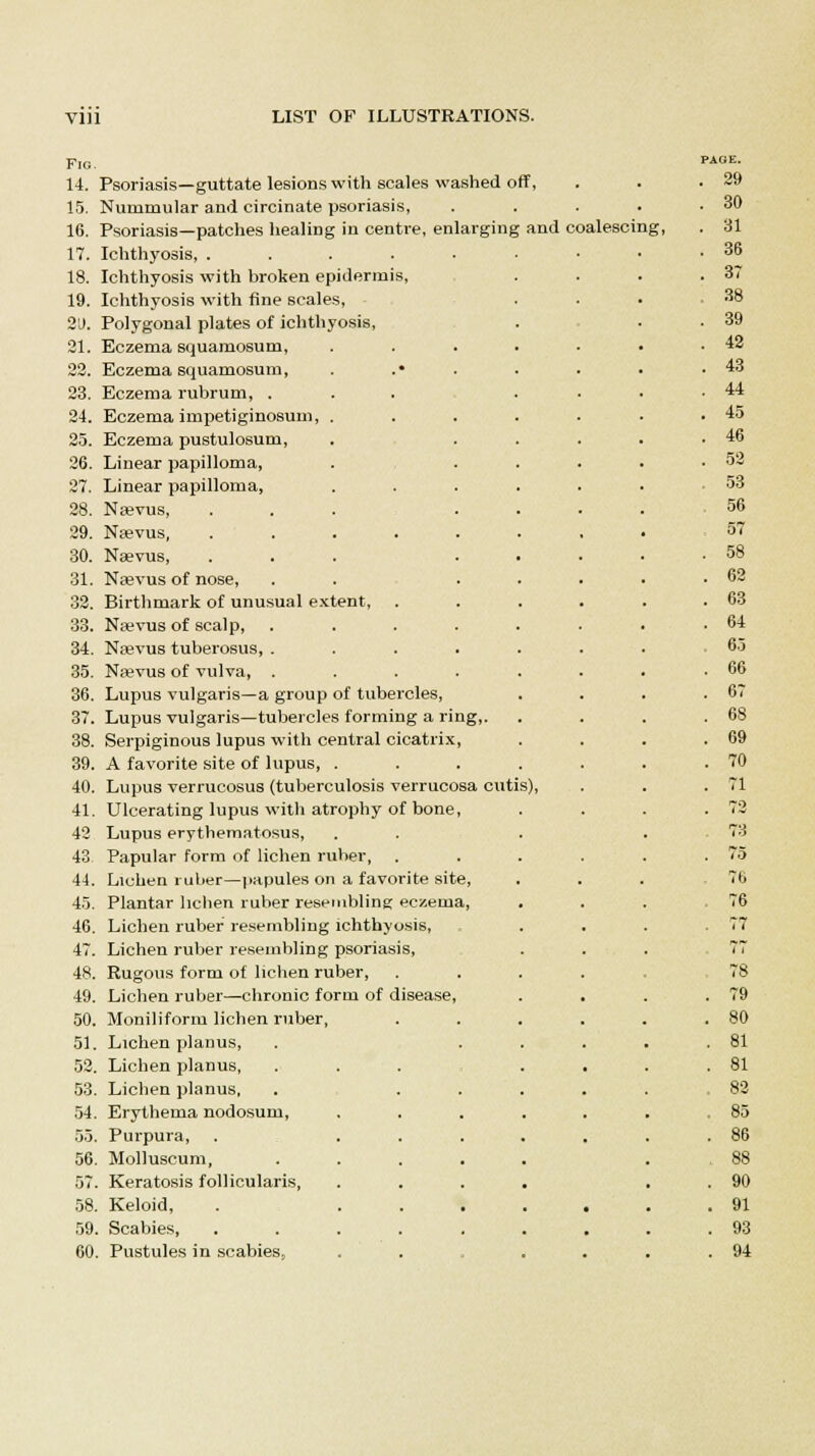 Fig. 14. Psoriasis—guttate lesions with scales washed off, 15. Nummular and circinate psoriasis, 16. Psoriasis—patches healing in centre, enlarging and coalescing, 17. Ichthyosis, .... 18. Ichthyosis with broken epidermis, 19. Ichthyosis with fine scales, 2'J. Polygonal plates of ichthyosis, 21. Eczema squamosum, 22. Eczema squamosum, 23. Eczema rubrum, . 24. Eczema impetiginosum, . 25. Eczema pustulosum, 26. Linear papilloma, 27. Linear papilloma, 28. Ntevus, 29. Nsevus, .... 30. Naevus, 31. Nsevus of nose, 32. Birthmark of unusual extent, 33. Naevus of scalp, 34. Ntevus tuberosus, . 35. Najvus of vulva, . 36. Lupus vulgaris—a group of tubercles, 37. Lupus vulgaris—tubercles forming a ring,. 38. Serpiginous lupus with central cicatrix, 39. A favorite site of lupus, . 40. Lupus verrucosus (tuberculosis verrucosa cutis), 41. Ulcerating lupus with atrophy of bone, 42 Lupus erythematosus, 43 Papular form of lichen ruber, 44. Lichen ruber—papules on a favorite site, 45. Plantar lichen ruber resembling eczema, 46. Lichen ruber resembling ichthyosis, 47. Lichen ruber resembling psoriasis, 48. Rugous form o£ lichen ruber, 49. Lichen ruber—chronic form of disease, 50. Moniliform lichen ruber, 51. Lichen planus, 52. Lichen planus, 53. Lichen planus, 54. Erythema nodosum, 55. Purpura, 56. Molluscum, 57. Keratosis follicularis, 58. Keloid, 59. Scabies, 60. Pustules in scabies,