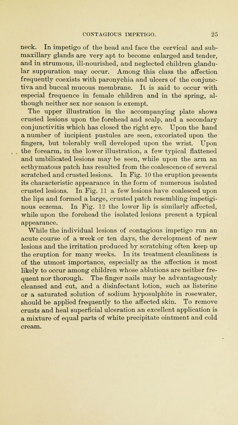 neck. In impetigo of the head and face the cervical and sub- maxillary glands are very apt to become enlarged and tender, and in strumous, ill-nourished, and neglected children glandu- lar suppuration may occur. Among this class the affection frequently coexists with paronychia and ulcers of the conjunc- tiva and buccal mucous membrane. It is said to occur with especial frequence in female children and in the spring, al- though neither sex nor season is exempt. The upper illustration in the accompanying plate shows crusted lesions upon the forehead and scalp, and a secondary conjunctivitis which has closed the right eye. Upon the hand a number of incipient pustules are seen, excoriated upon the fingers, but tolerably well developed upon the wrist. Upon the forearm, in the lower illustration, a few typical flattened and umbilicated lesions may be seen, while upon the arm an ecthymatous patch has resulted from the coalescence of several scratched and crusted lesions. In Fig. 10 the eruption presents its characteristic appearance in the form of numerous isolated crusted lesions. In Fig. 11a few lesions have coalesced upon the lips and formed a large, crusted patch resembling impetigi- nous eczema. In Fig. 12 the lower lip is similarly affected, while upon the forehead the isolated lesions present a typical appearance. While the individual lesions of contagious impetigo run an acute course of a week or ten days, the development of new lesions and the irritation produced by scratching often keep up the eruption for many weeks. In its treatment cleanliness is of the utmost importance, especially as the affection is most likely to occur among children whose ablutions are neither fre- quent nor thorough. The finger nails may be advantageously cleansed and cut, and a disinfectant lotion, such as listerine or a saturated solution of sodium hyposulphite in rosewater, should be applied frequently to the affected skin. To remove crusts and heal superficial ulceration an excellent application is a mixture of equal parts of white precipitate ointment and cold cream.