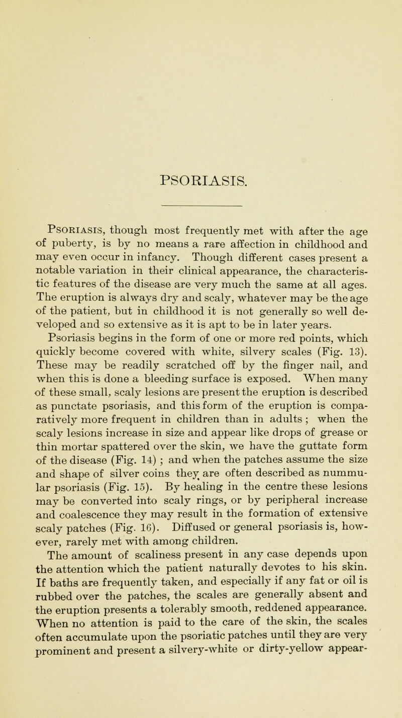 PSORIASIS. Psoriasis, though most frequently met with after the age of puberty, is by no means a rare affection in childhood and may even occur in infancy. Though different cases present a notable variation in their clinical appearance, the characteris- tic features of the disease are very much the same at all ages. The eruption is always dry and scaly, whatever may be the age of the patient, but in childhood it is not generally so well de- veloped and so extensive as it is apt to be in later years. Psoriasis begins in the form of one or more red points, which quickly become covered with white, silvery scales (Fig. 13). These may be readily scratched off by the finger nail, and when this is done a bleeding surface is exposed. When many of these small, scaly lesions are present the eruption is described as punctate psoriasis, and this form of the eruption is compa- ratively more frequent in children than in adults ; when the scaly lesions increase in size and appear like drops of grease or thin mortar spattered over the skin, we have the guttate form of the disease (Fig. 14) ; and when the patches assume the size and shape of silver coins they are often described as nummu- lar psoriasis (Fig. 15). By healing in the centre these lesions may be converted into scaly rings, or by peripheral increase and coalescence they may result in the formation of extensive scaly patches (Fig. 1G). Diffused or general psoriasis is, how- ever, rarely met with among children. The amount of scaliness present in any case depends upon the attention which the patient naturally devotes to his skin. If baths are frequently taken, and especially if any fat or oil is rubbed over the patches, the scales are generally absent and the eruption presents a tolerably smooth, reddened appearance. When no attention is paid to the care of the skin, the scales often accumulate upon the psoriatic patches until they are very prominent and present a silvery-white or dirty-yellow appear-