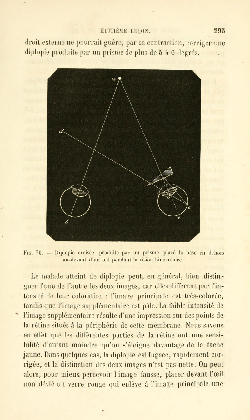 droit externe ne pourrait guère, par sa contraction, corriger une diplopie produite par un prisme de plus de 5 à 6 degrés. Fie, 70. — Diplopie croisée produite par un prisme placé la base en dehors au-devant d'un œil pendant la vision binoculaire. Le malade atteint de diplopie peut, en général, bien distin- guer l'une de l'autre les deux images, car elles différent par l'in- tensité de leur coloration : l'image principale est très-colorée, tandis que l'image supplémentaire est pâle. La faible intensité de l'image supplémentaire résulte d'une impression sur des points de la rétine situés à la périphérie de cette membrane. Nous savons en effet que les différentes parties de la rétine ont une sensi- bilité d'autant moindre qu'on s'éloigne davantage de la tache jaune. Dans quelques cas, la diplopie est fugace, rapidement cor- rigée, et la distinction des deux images n'est pas nette. On peut alors, pour mieux percevoir l'image fausse, placer devant l'œil non dévié un verre rouge qui enlève à l'image principale une