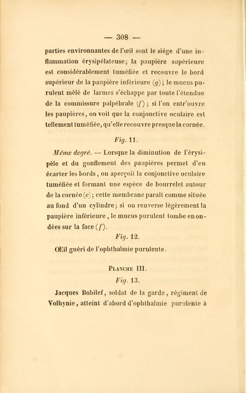 parties environnantes de l'œil sont le siège d'une in- flammation érysipélateusej la paupière supérieure est considérablement tuméfiée et recouvre le bord supérieur de la paupière inférieure (g) • le mucus pu- rulent mêlé de larmes s'échappe par toute l'étendue de la commissure palpébrale (/*) ; si l'on entr'ouvre les paupières, on voit que la conjonctive oculaire est tellement tuméfiée, qu'elle recouvre presque la cornée. Fig. 11. Même degré. — Lorsque la diminution de l'érysi- pèle et du gonflement des paupières permet d'en écarter les bords, on aperçoit la conjonctive oculaire tuméfiée et formant une espèce de bourrelet autour de la cornée (e) ; cette membrane paraît comme située au fond d'un cylindre ; si on renverse légèrement la paupière inférieure, le mucus purulent tombe en on- dées sur la face(/). Fig. 12. OEil guéri de l'oplithalmie purulente. Planche III. Fig. 13. Jacques Bobilef, soldat de la garde, régiment de Volhynie, atteint d'abord d'ophthalmie purulente à