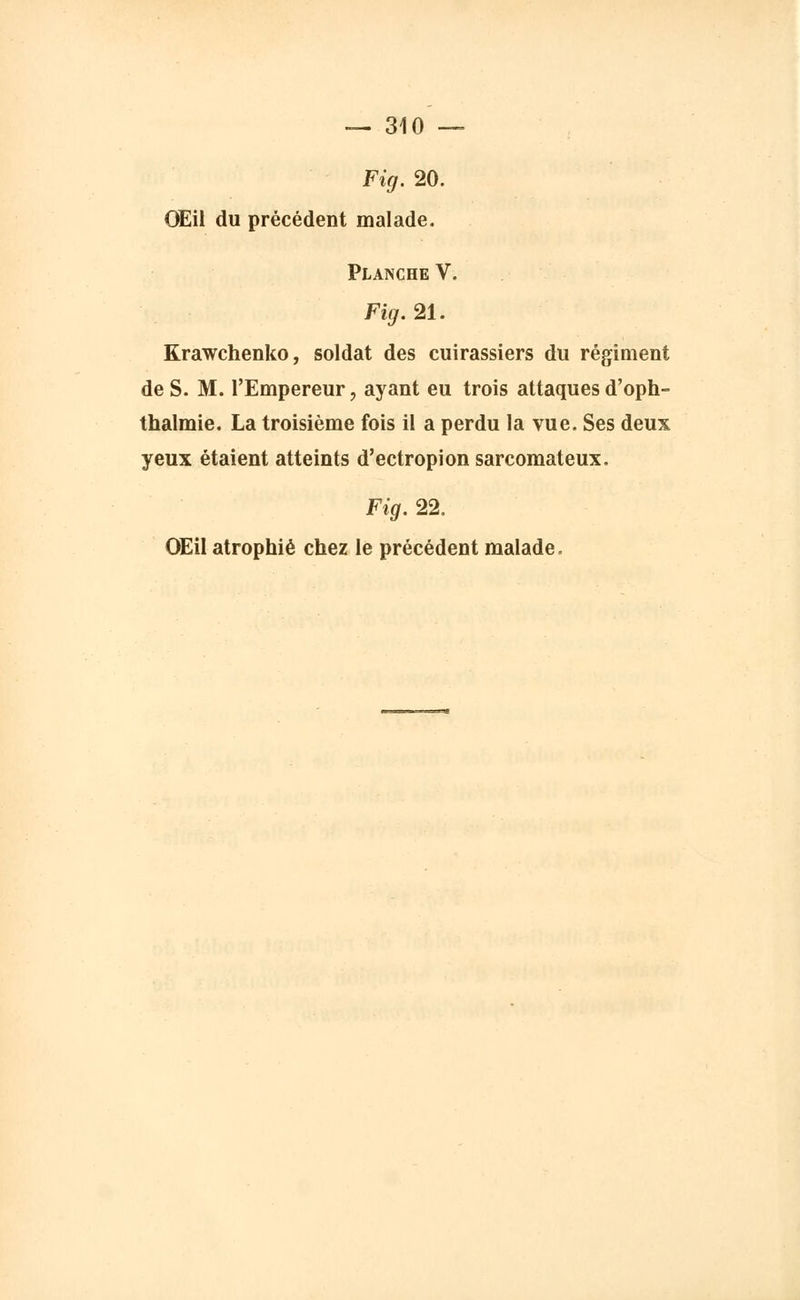 Fig. 20. Œil du précédent malade. Planche V. Fig. 21. Krawchenko, soldat des cuirassiers du régiment de S. M. l'Empereur, ayant eu trois attaques d'oph- thalmie. La troisième fois il a perdu la vue. Ses deux yeux étaient atteints d'ectropion sarcomateux. Fig. 22. OEil atrophié chez le précédent malade.