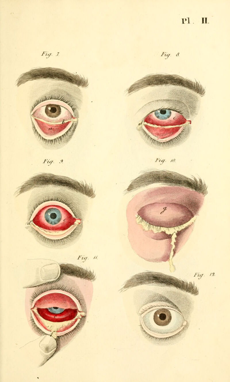 Fiar. 7 /■y â. Fur. << wt*< FÛT. /(>