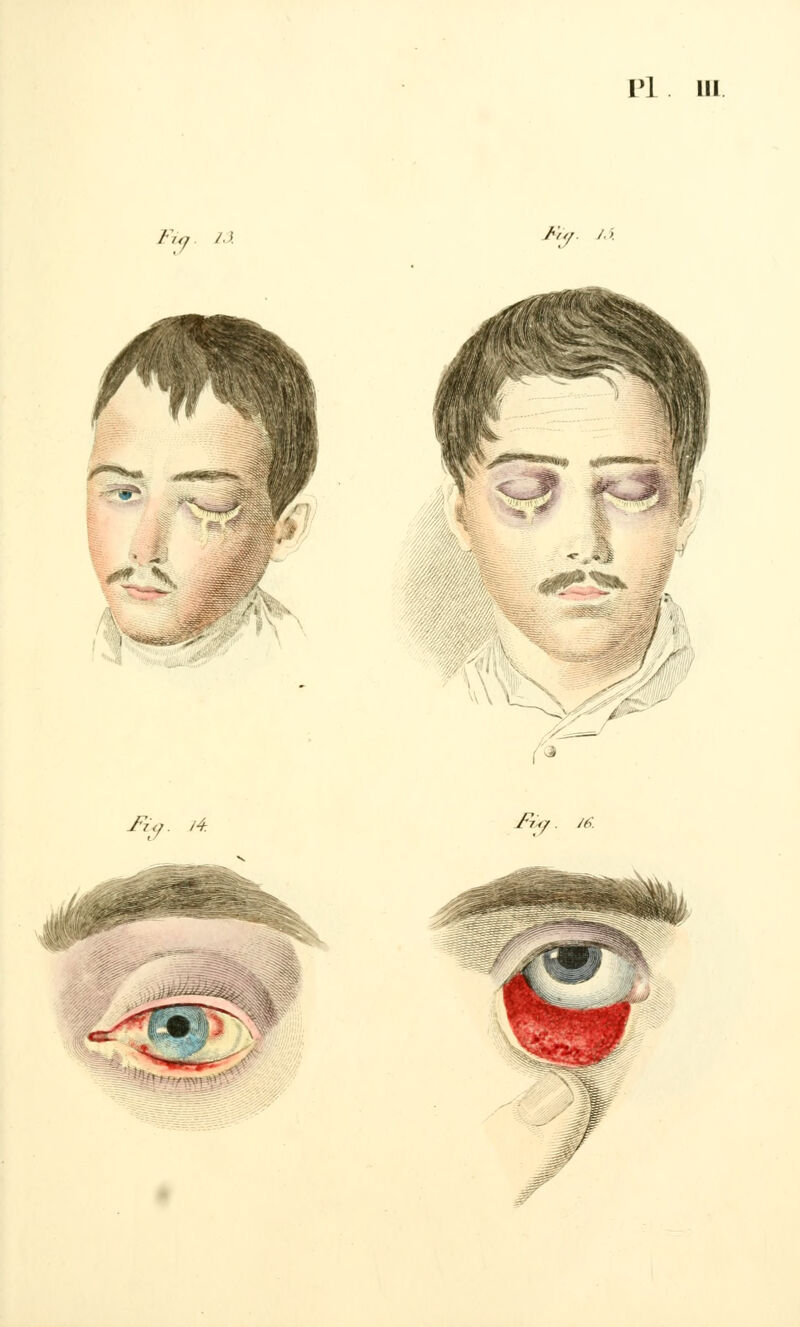 vl m Fia /y Fty. /■>. Fùg. 16.