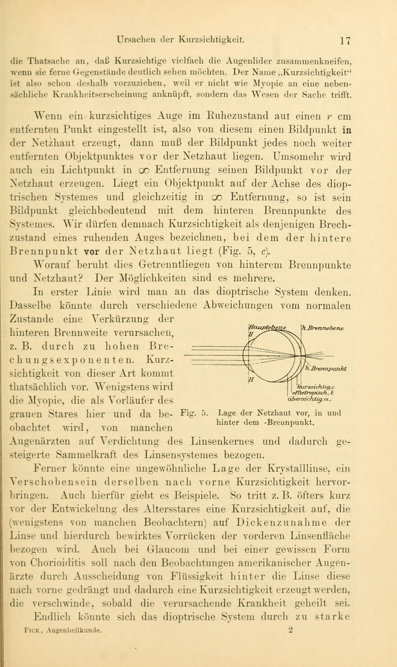 die Thatsache an, daß Kurzsichtige vielfach die Augenlider zusammenkneifen, wenn sie ferne Gegenstände deutlich sehen möchten. Der Name ,,Kurzsichtigkeit ist also schon deshalb vorzuziehen, weil er nicht wie Myopie an eine neben- sächliche Krankheitserscheinung anknü]ift, sondern das Wesen der Sache trifft. Wenu ein kurzsichtiges Auge im Ruhezustand aut einen r cm entfernten Punkt eingestellt ist. also von diesem einen Bildpunkt in der Netzhaut erzeugt, dann muß der Bildpunkt jedes noch weiter entfernten Objektpunktes vor der Netzhaut liegen. Umsomehr wird auch ein Lichtpunkt in oc Entfernung seinen Bildpunkt vor der Netzhaut erzeugen. Liegt ein Objektpunkt auf der Achse des diop- trischen Systemes und gleichzeitig in 00 Entfernung, so ist sein Bildpunkt gleichbedeutend mit dem hinteren Brennpunkte des Systemes. Wir dürfen demnach Kurzsichtigkeit als denjenigen Brech- zustand eines ruhenden Auges bezeichnen, bei dem der hintere Brennpunkt vor der Netzhaut liegt (Fig. 5, c). Worauf beruht dies Getrenntliegen von hinterem Brennpunkte und Netzhaut? Der Möglichkeiten sind es mehrere. In erster Linie wird man an das dioptrische System denken. Dasselbe könnte durch verschiedene AbAveichungen vom normalen Zustande eine Verkürzung der hinteren Brennweite verursachen^ —s—^ z. B. durch zu hohen Bre- chungsexponenten. Kurz- sichtigkeit von dieser Art kommt thatsächlich vor. Wenigstens w^ird die Myopie, die als Vorläufer des grauen Stares hier und da be- Fig. h. Lage der Netzbaut vor, in und 1 1 , , • 1 1 hinter dem -Brennpunkt, obachtet wird, von manchen Augenärzten auf Verdichtung des Linsenkernes und dadurch ge- steigerte Sammelkraft des Linsensystemes bezogen. Ferner könnte eine ungewöhnliche Lage der Krystalllinse, ein Verschobensein derselben nach vorne Kurzsichtigkeit hervor- bringen. Auch hierfür giebt es Beispiele. So tritt z. B. öfters kurz vor der Entwickelung des Altersstares eine Kurzsichtigkeit auf, die (wenigstens von manchen Beobachtern) auf Dickenzunahme der Linse und hierdurch bewirktes Vorrücken der vorderen Linsenfläche bezogen wird. Auch bei Glaucom und bei einer gewissen Form von Chorioiditis soll nach den Beobachtungen amerikanischer Augen- ärzte durch Ausscheidung von Flüssigkeit hinter die Linse diese nach vorne gedrängt und dadurch eine Kurzsichtigkeit erzeugt werden, die verschwinde, sobald die verursachende Krankheit geheilt sei. Endlich könnte sich das dioptrische System durch zu starke FicK, Augenheilkunde. 2