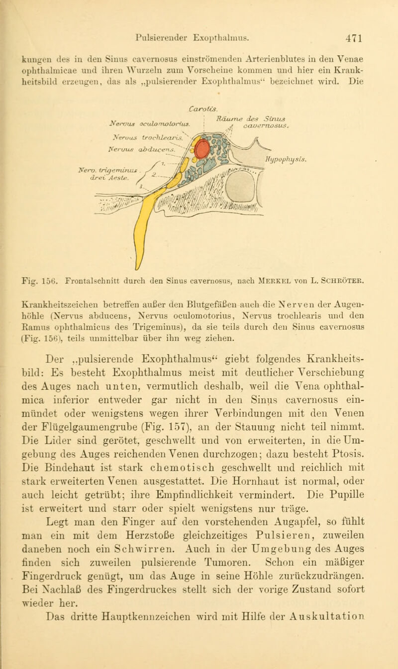 klingen des in den Sinus cavernosus einströmenden Arterienblutea in den Venae ophthahnicae und ihren Wurzeln zum Vorscheine kommen und hier ein Ki-ank- heitsbild erzeugen, das als „pulsierender Exojjhthalmus bezeichnet wird. Die Carotis. . Räume des Sinus Jfernus oculomotorius. \ ^ cavernosus. yeruus trochletjj^ Uijpophusis. Fig. 15*5. Frontalschnitt durch den Sinus cavernosus, nach Merkel von L. Scheötek. Krankheitszeichen betreften außer den Blutgefäßen auch die Nerven der Augen- höhle (Nervus abducens, Nervus oculomotorius, Nervus trochlearis und den Ramus ophthalmicus des Trigeminus), da sie teils durch den Sinus cavernosus (Fig. 15GI, teils unmittelbar über ihn weg ziehen. Der ,.pulsierende Exophthalmus'- giebt folgendes Krankheits- bild: Es besteht Exophthalmus meist mit deutlicher Verschiebung des Auges nach unten, vermutlich deshalb, weil die Vena ophthal- mica inferior entweder gar nicht in den Sinus cavernosus ein- mündet oder wenigstens wegen ihrer Verbindungen mit den Venen der Flügelgaumengrube (Fig. 157), an der Stauung nicht teil nimmt. Die Lider sind gerötet, geschwellt und von erweiterten, in die Um- gebung des Auges reichenden Venen durchzogen; dazu besteht Ptosis. Die Bindehaut ist stark chemotisch geschwellt und reichlich mit stark erweiterten Venen ausgestattet. Die Hornhaut ist normal, oder auch leicht getrübt; ihre Empfindlichkeit vermindert. Die Pupille ist erweitert und starr oder spielt wenigstens nur träge. Legt man den Finger auf den vorstehenden Augapfel, so fühlt man ein mit dem Herzstoße gleichzeitiges Pulsieren, zuweilen daneben noch ein Schwirren. Auch in der Umgebung des Auges finden sich zuweilen pulsierende Tumoren. Schon ein mäßiger Fingerdruck genügt, um das Auge in seine Höhle zurückzudrängen. Bei Nachlaß des Fingerdruckes stellt sich der vorige Zustand sofort wieder her. Das dritte Hauptkennzeichen wird mit Hilfe der Auskultation