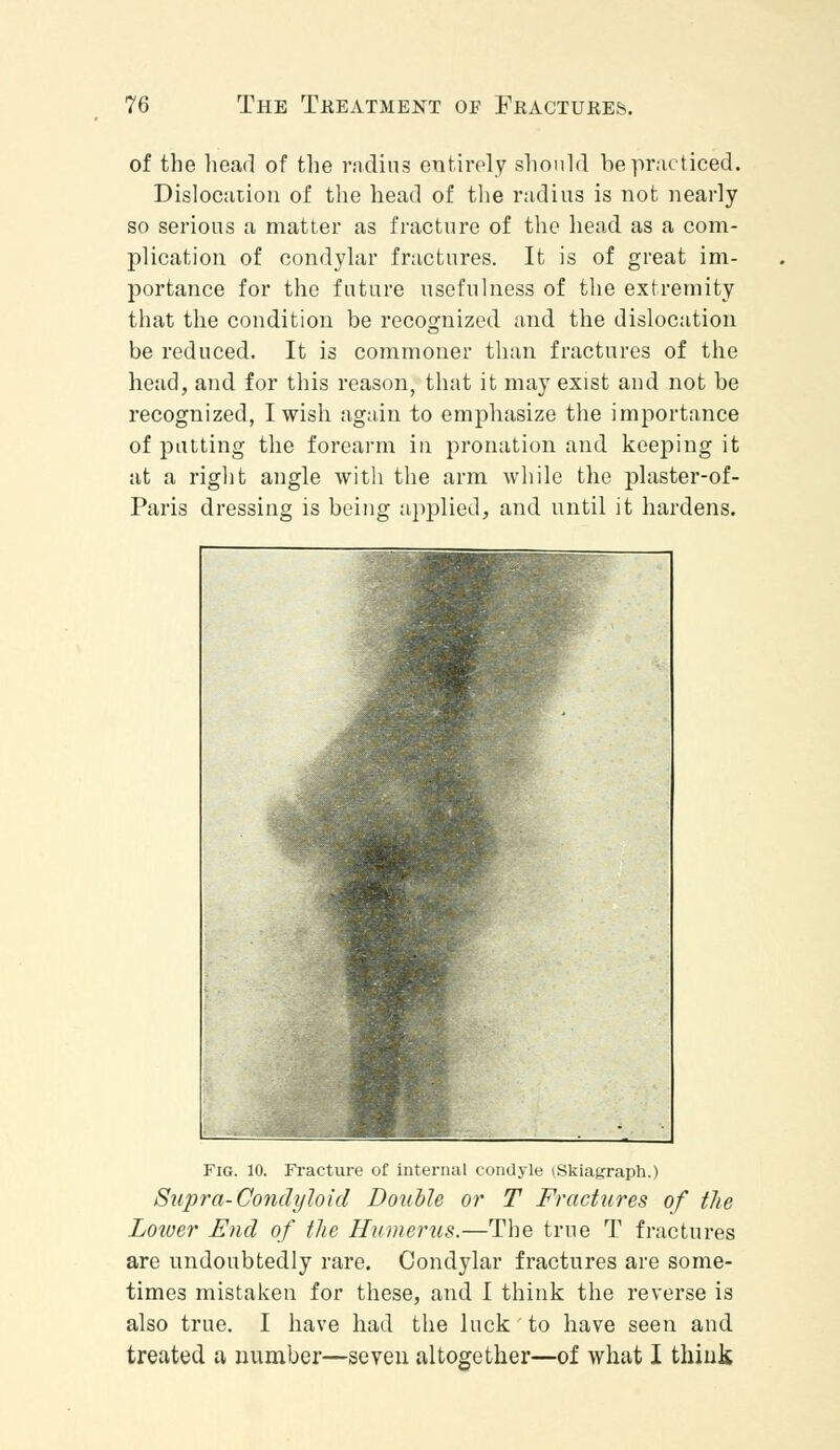 of the head of the radius entirely should be practiced. Dislocation of the head of the radius is not nearly so serious a matter as fracture of the head as a com- plication of condylar fractures. It is of great im- portance for the future usefulness of the extremity that the condition be recognized and the dislocation be reduced. It is commoner than fractures of the head, and for this reason, that it may exist and not be recognized, I wish again to emphasize the importance of putting the forearm in pronation and keeping it at a right angle with the arm while the plaster-of- Paris dressing is being applied, and until it hardens. Fig. 10. Fracture of internal condyle (Skiagraph.) Supra-Condyloid Double or T Fractures of the Lower End of the Humerus.—The true T fractures are undoubtedly rare. Condylar fractures are some- times mistaken for these, and I think the reverse is also true. I have had the luck to have seen and treated a number—seven altogether—of what I think