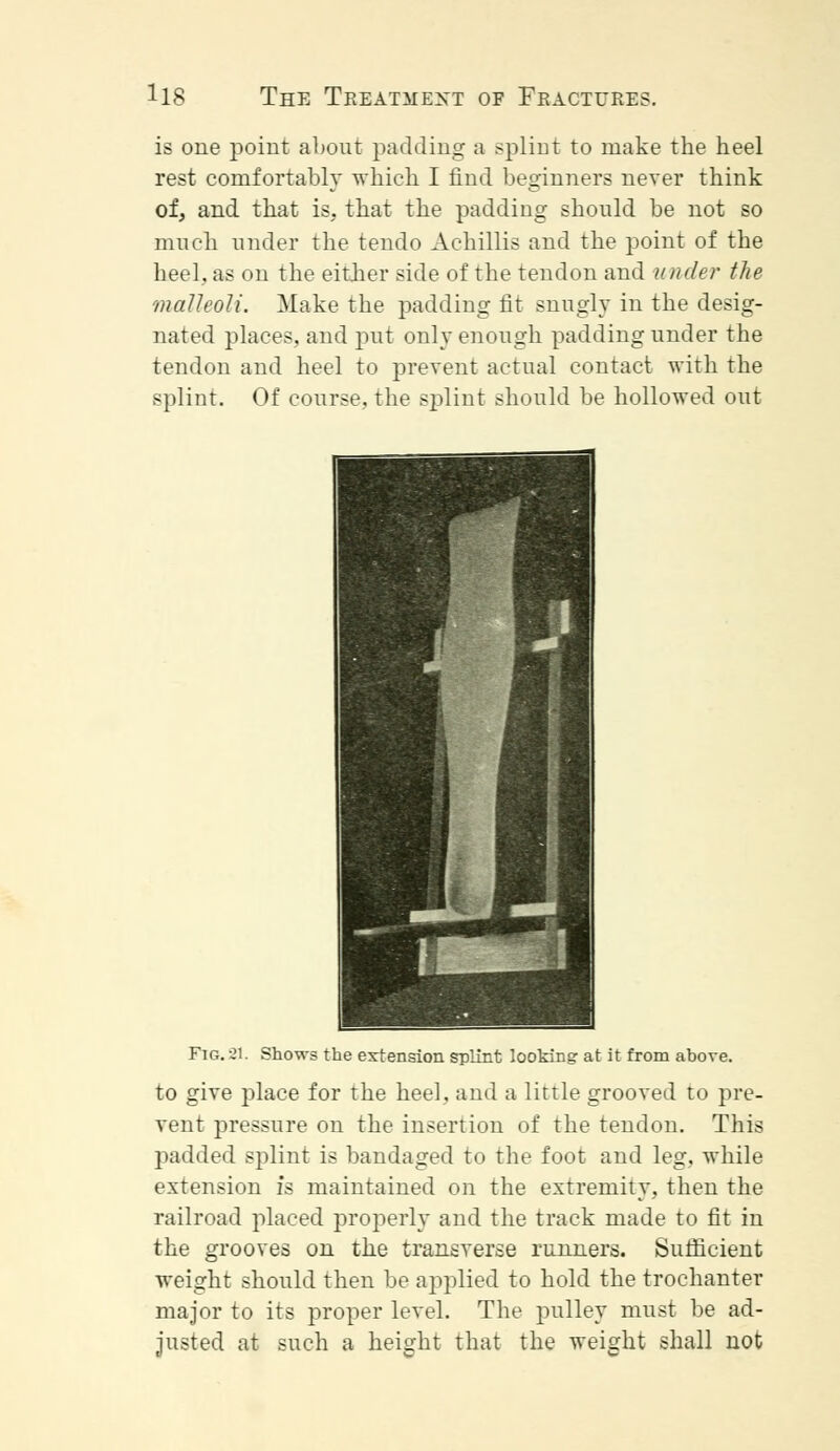 is one point about padding a splint to make the heel rest comfortably which I find beginners never think of, and that is. that the padding should be not so much under the tendo Achillis and the point of the heel, as on the either side of the tendon and under the malleoli. Make the padding fit snugly in the desig- nated places, and put only enough padding under the tendon and heel to prevent actual contact with the splint. Of course, the splint should be hollowed out in 1 - 7 i i i Fig. 21. Shows the extension splint looking at it from above, to give place for the heel, and a little grooved to pre- vent pressure on the insertion of the tendon. This padded splint is bandaged to the foot and leg. while extension is maintained on the extremity, then the railroad placed properly and the track made to fit in the grooves on the transverse runners. Sufficient weight should then be applied to hold the trochanter major to its proper level. The pulley must be ad- justed at such a height that the weight shall not