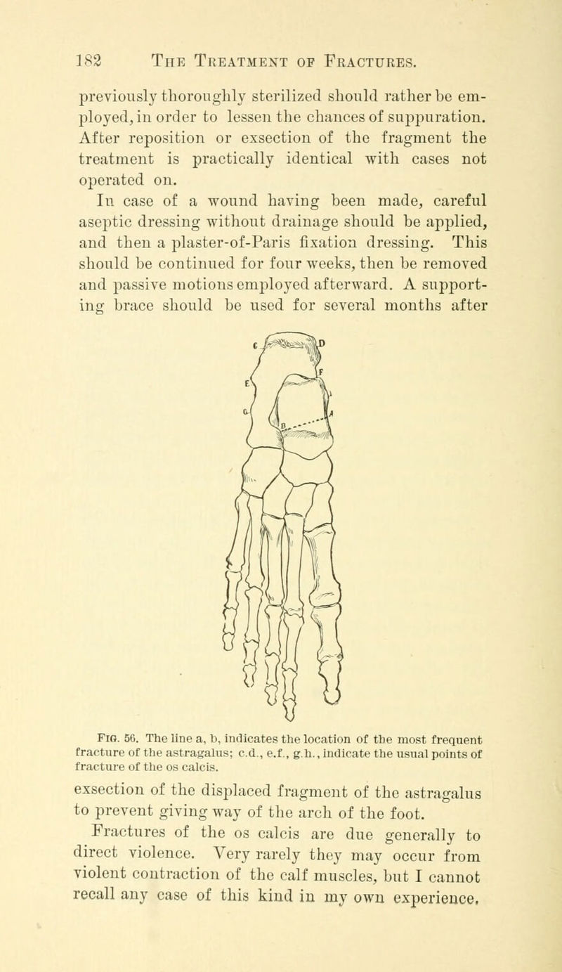 previously thoroughly sterilized should rather be em- ployed, in order to lessen the chances of suppuration. After reposition or exsection of the fragment the treatment is practically identical with cases not operated on. In case of a wound having been made, careful aseptic dressing without drainage should be applied, and then a plaster-of-Paris fixation dressing. This should be continued for four weeks, then be removed and passive motions employed afterward. A support- ing brace should be used for several months after Fig. 56. The line a, b, indicates the location of the most frequent fracture of the astragalus; c.d., e.f., g.h., indicate the usual points of fracture of the os calcis. exsection of the displaced fragment of the astragalus to prevent giving way of the arch of the foot. Fractures of the os calcis are due generally to direct violence. Very rarely they may occur from violent contraction of the calf muscles, but I cannot recall any case of this kind in my own experience.