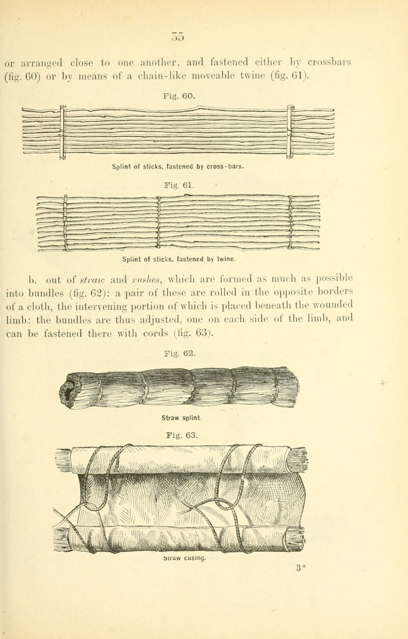 .)■) or arranged close to one another, and fastened either by crossbars (fig. 60) or by means of a chain-like moveable twine (fig. 61). Fig. 60. Splint of sticks, fastened by cross-bars. Fig. 61. Splint of sticks, fastened by twine. 1). out of straw and rushes, which arc tunned as much as possible into bundles (fig. 62): a pair of these are rolled in the opposite borders of a cloth, the intervening portion of which is placed beneath the wounded limb: the bundles are thus adjusted, one on each side of the limb, and can be fastened there with cords (fig. 63). Fig. 62. Straw splint. Fig. 63. Straw casing.