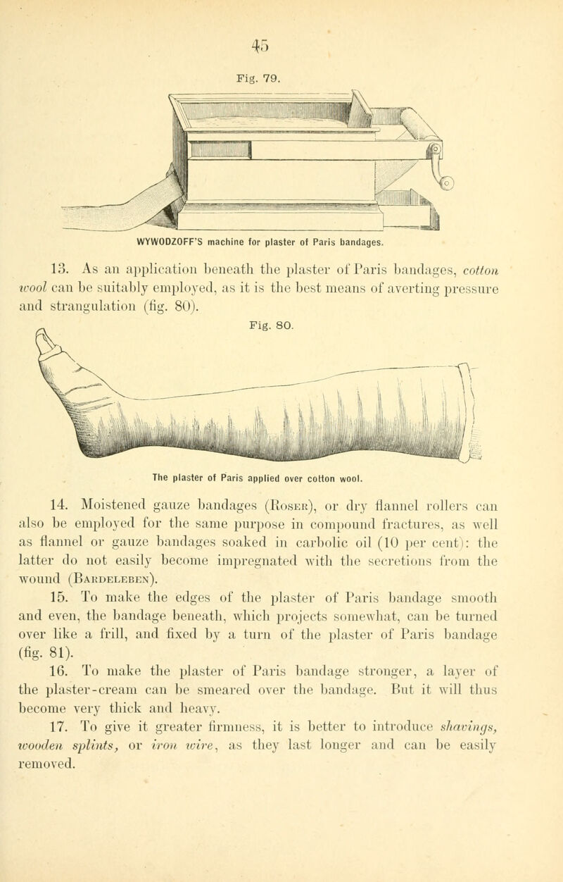 WYWODZOFFS machine for plaster of Paris bandages, 13. As an application beneath the plaster of Paris bandages, cotton ivool can be suitably employed, as it is the best means of averting pressure and strangulation (fig. 80). Fig. 80. The plaster of Paris applied over cotton wool. 14. Moistened gauze bandages (Koser), or dry flannel rollers can also be employed for the same purpose in compound fractures, as well as flannel or gauze bandages soaked in carbolic oil (10 per cent): the latter do not easily become impregnated with the secretions from the wound (Baudelebj:n). 15. To make the edges of the plaster of Paris bandage smooth and even, the bandage beneath, which projects somewhat, can be turned over like a frill, and fixed by a turn of the plaster of Paris bandage (%. 81). 16. To make the plaster of Paris bandage stronger, a layer of the plaster-cream can be smeared over the bandage. But it will thus become very thick and heavy. 17. To give it greater firmness, it is better to introduce shavings, wooden splints, or iron icire, as they last longer and can be easily removed.