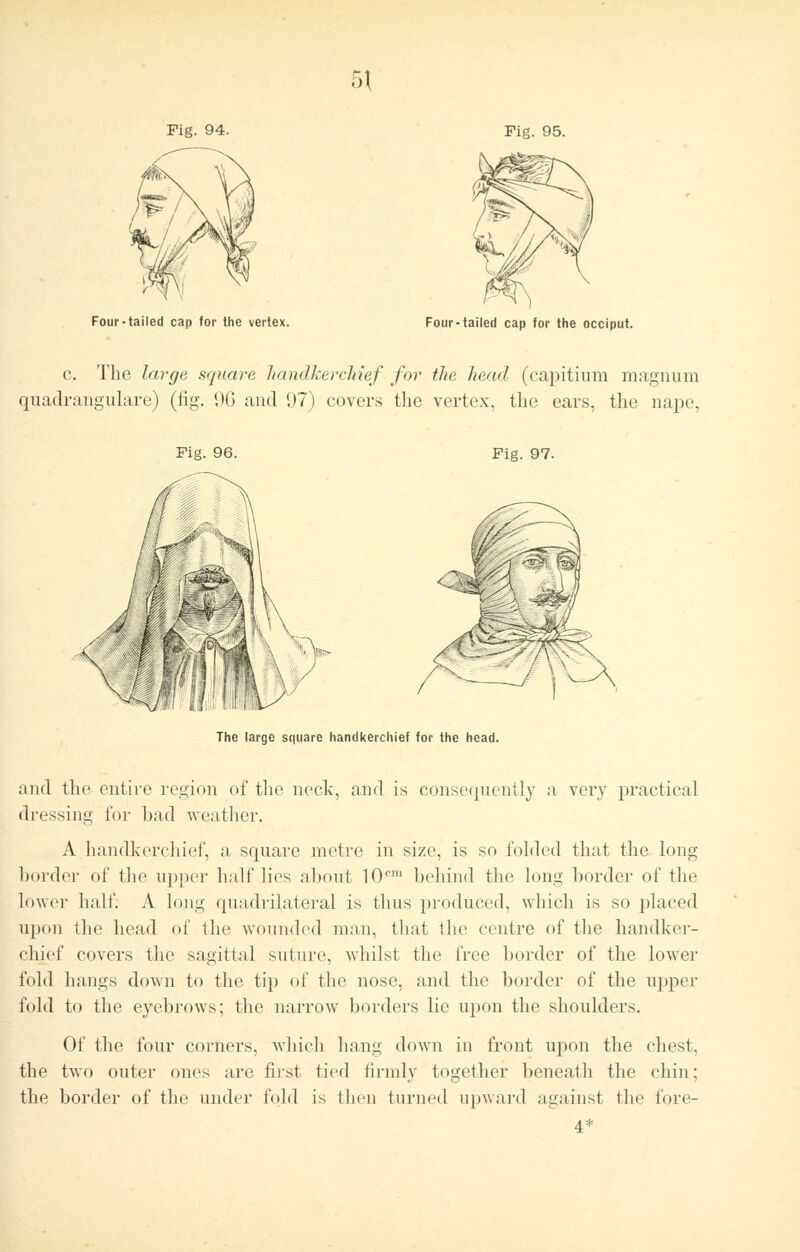 ro\ Fig. 94. Fie. 95. Four-tailed cap for the vertex. Four-tailed cap for the occiput. c. The large square, handkerchief for the head (capitium magnum quadrangulare) (fig. 96 and (.)7) covers the vertex, the ears, the nape, Fig. 96. Fig. 97. The large square handkerchief for the head. and the entire region of the neck, and is consequently a very practical dressing for had weather. A handkerchief, a square metre in size, is so folded that the long border of the upper half lies about !0rm behind the long border of the lower half. A long quadrilateral is thus produced, which is so placed upon the head of the wounded man, that the centre of the handker- chief covers the sagittal suture, whilst the free border of the lower fold hangs down to the tip of the nose, and the border of the upper fold to the eyebrows; the narrow borders lie upon the shoulders. Of the four corners, which hang down in front upon the chest, the two outer ones are first tied firmly together beneath the chin; the border of the under told is then turned upward against the fore- 4*