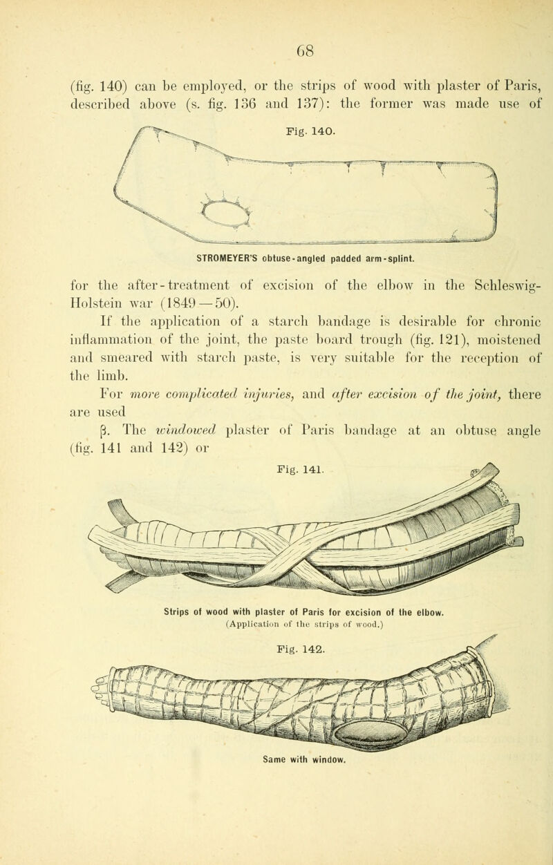 (fig. 140) can be employed, or the strips of wood with plaster of Paris, described above (s. fig. 136 and 137): the former was made use of Fig. 140. STROMEYER'S obtuse-angled padded arm-splint. for the after-treatment of excision of the elbow in the Schleswig- Holstein war (1849 — 50). If the application of a starch bandage is desirable for chronic inflammation of the joint, the paste board trough (fig. 121), moistened and smeared with starch paste, is very suitable for the reception of the limb. For more complicated injuries, and after excision of the joint, there are used [3. The icindowed plaster of Paris bandage at an obtuse angle (fig. 141 and 142) or Strips of wood with plaster of Paris for excision of the elbow. (Application of the strips of wood.) Same with window.